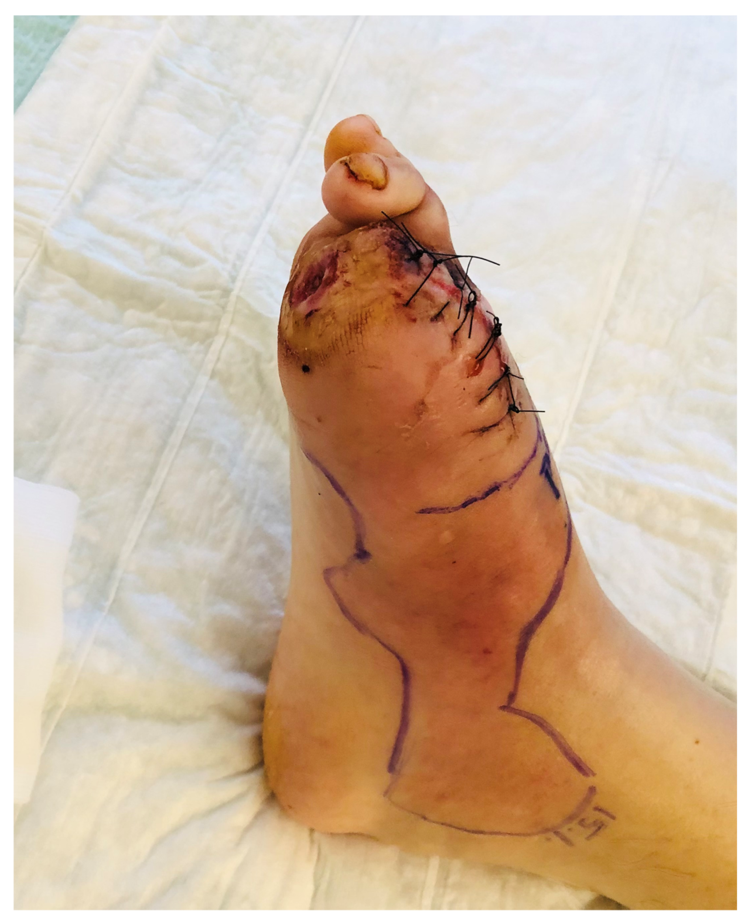 Medicina 57 00339 g002 Medicina 57 00339 g002