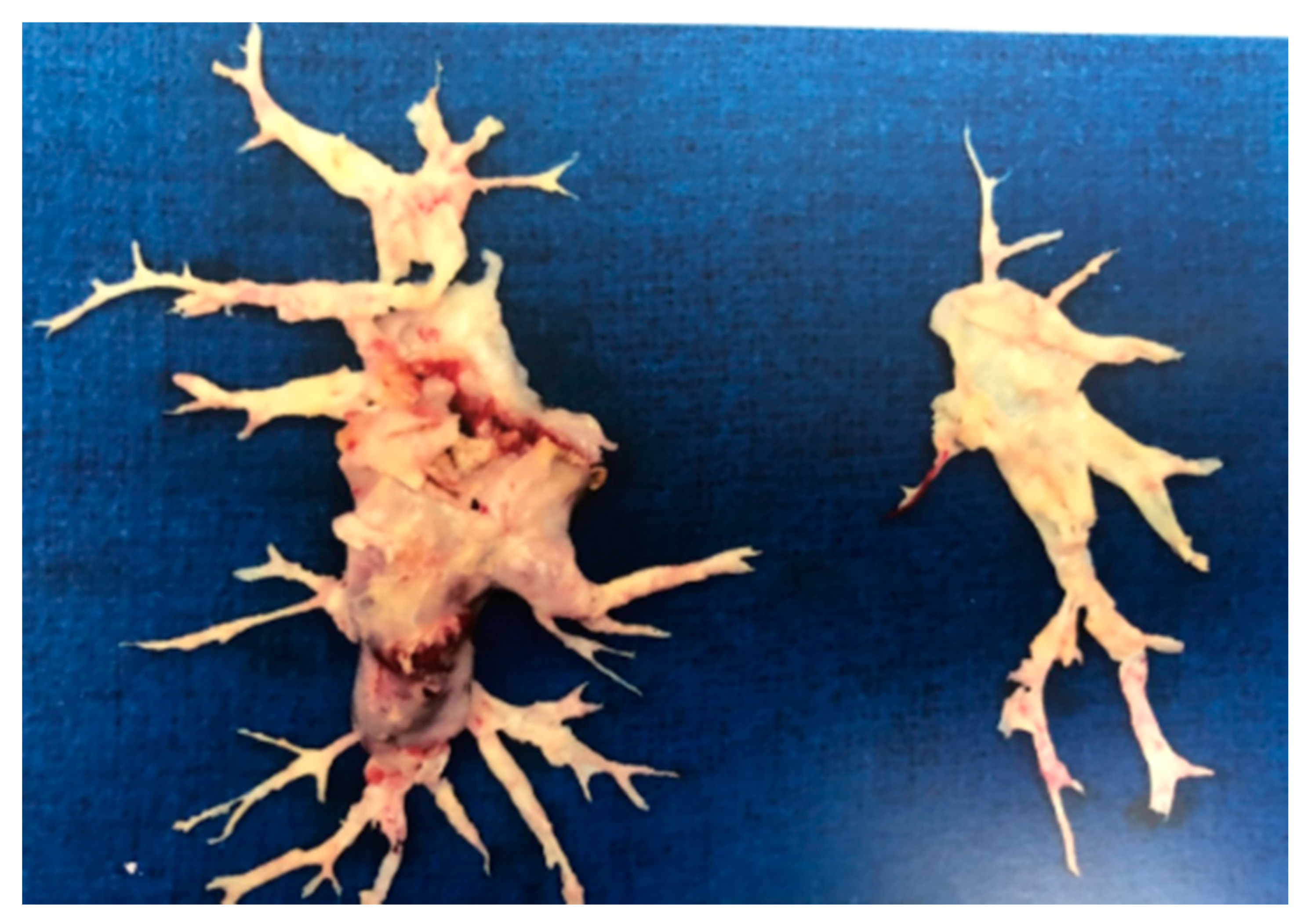 Medicina 57 00355 g004