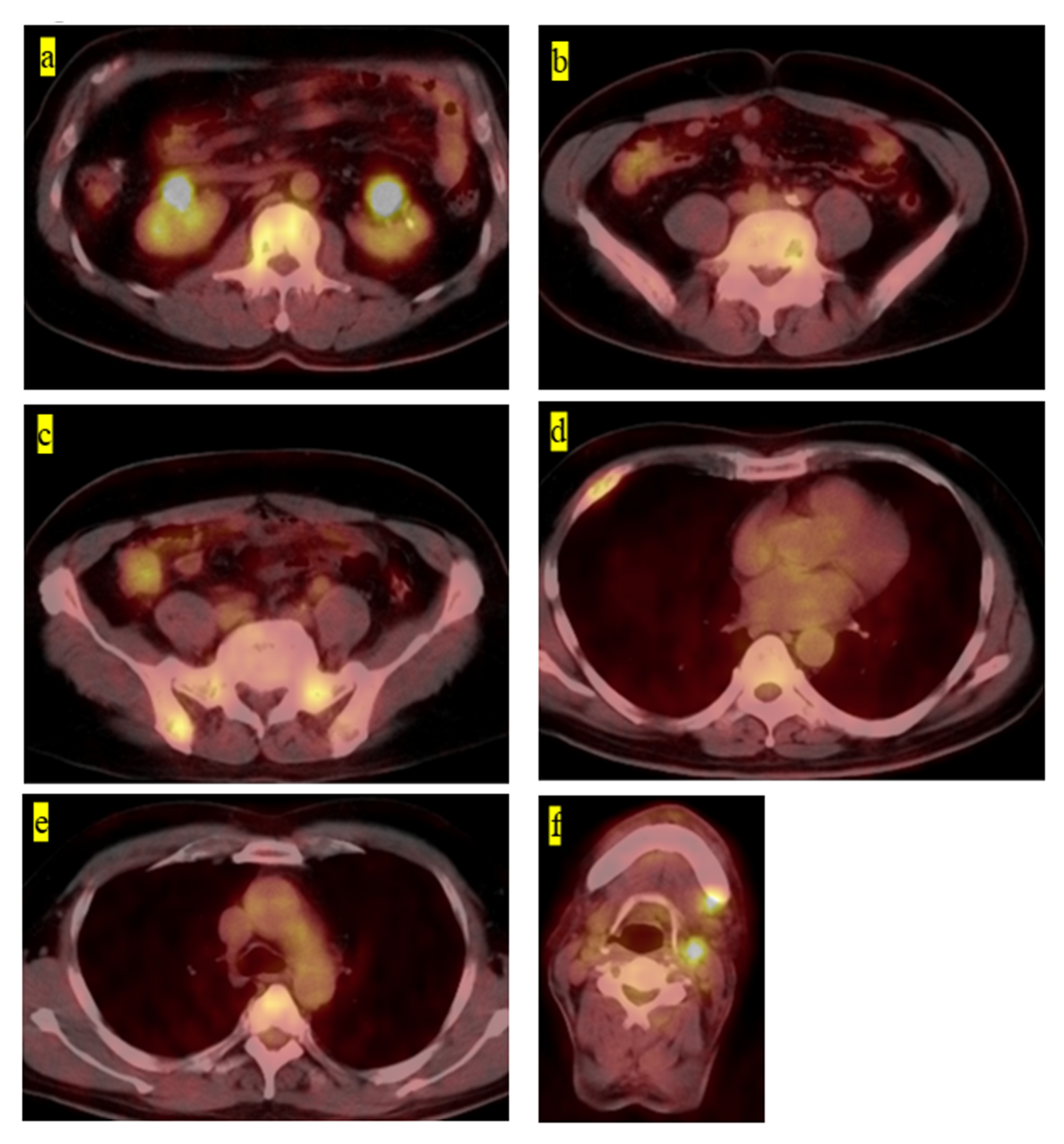 Medicina 57 00356 g002