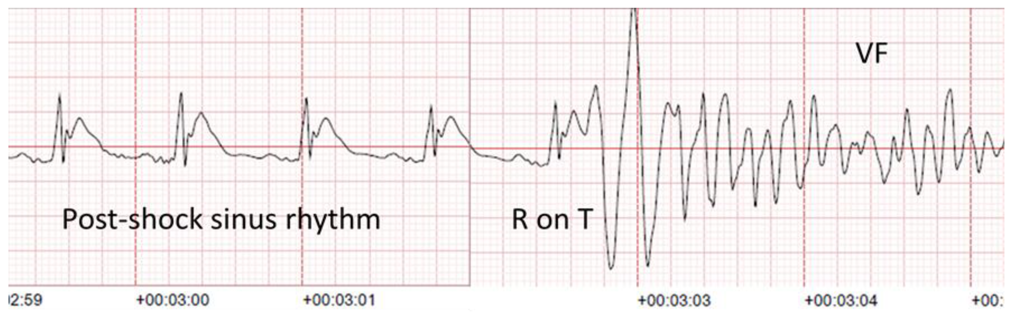 Medicina 57 00358 g002