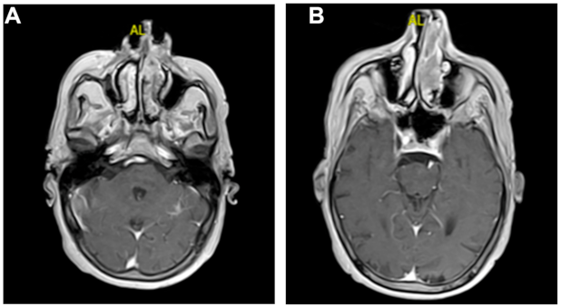 Medicina 57 00359 g002