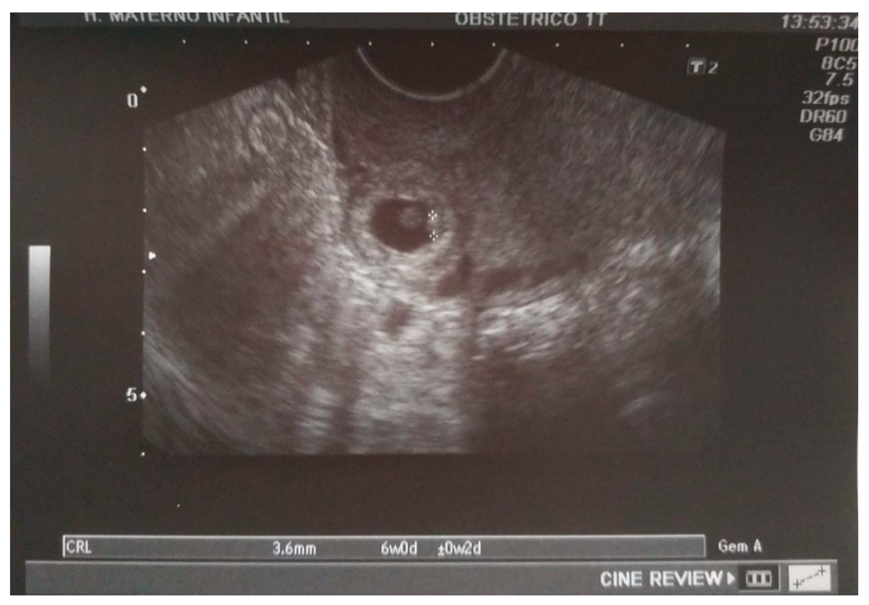 Medicina 57 00362 g002