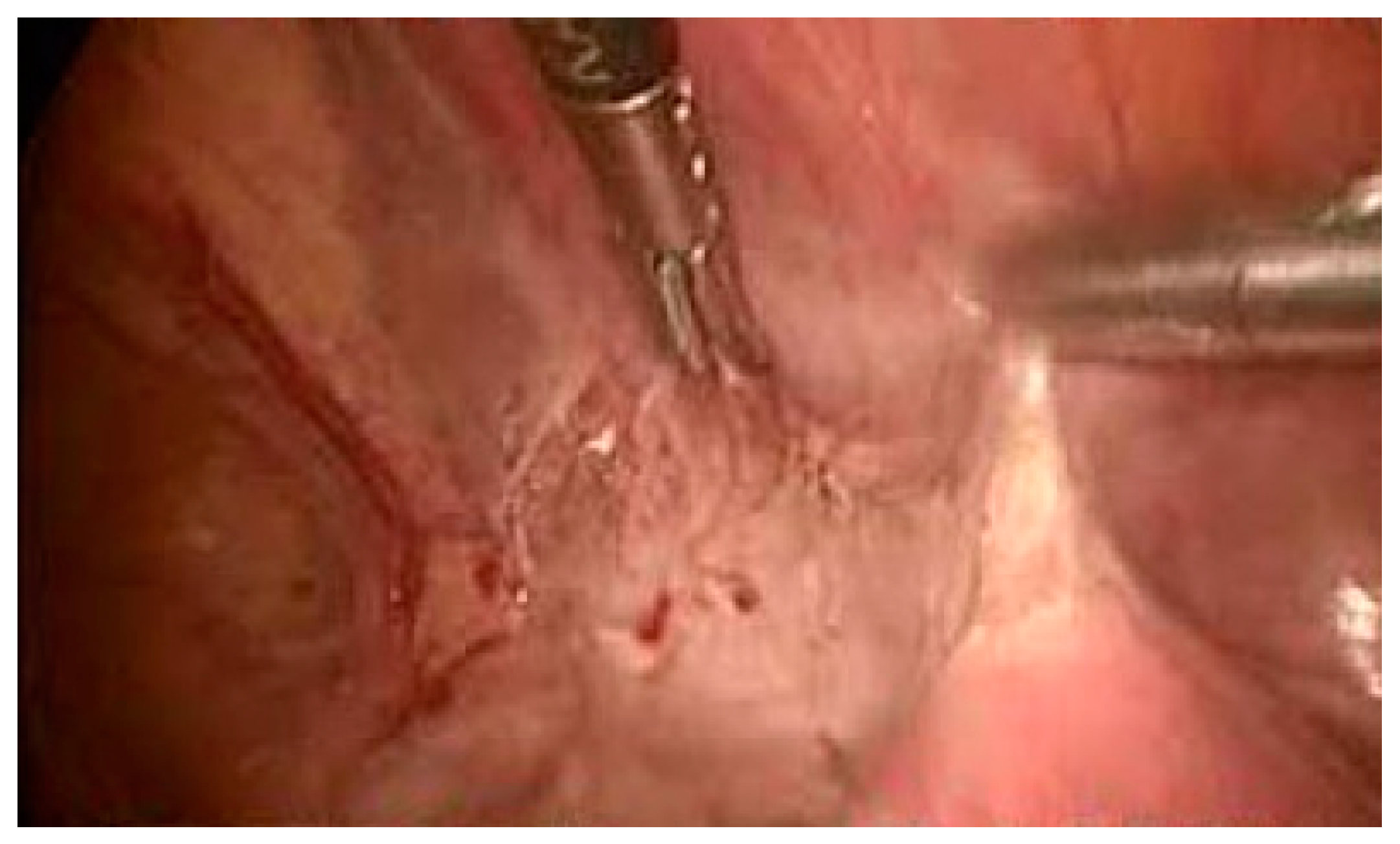 Medicina 57 00362 g003