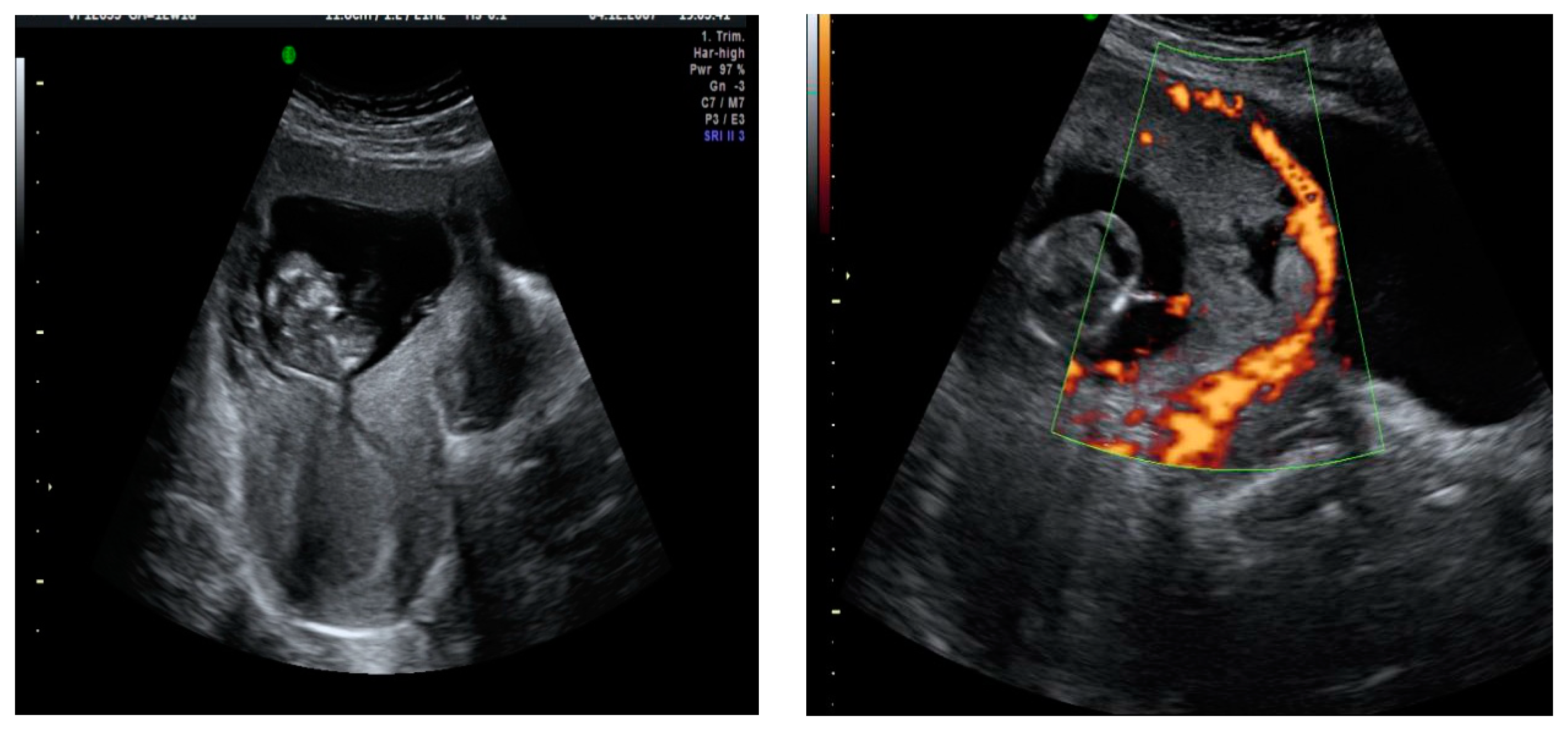 Medicina 57 00362 g005