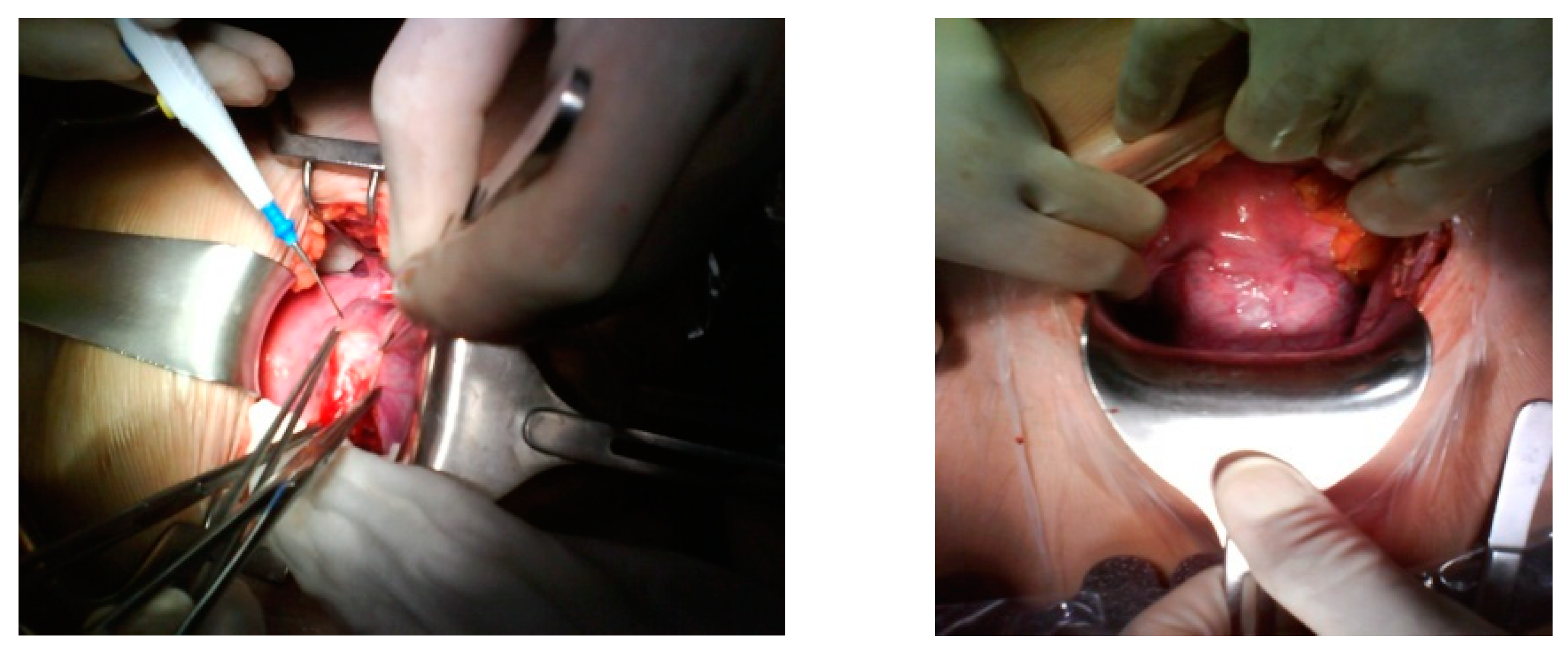 Medicina 57 00362 g006