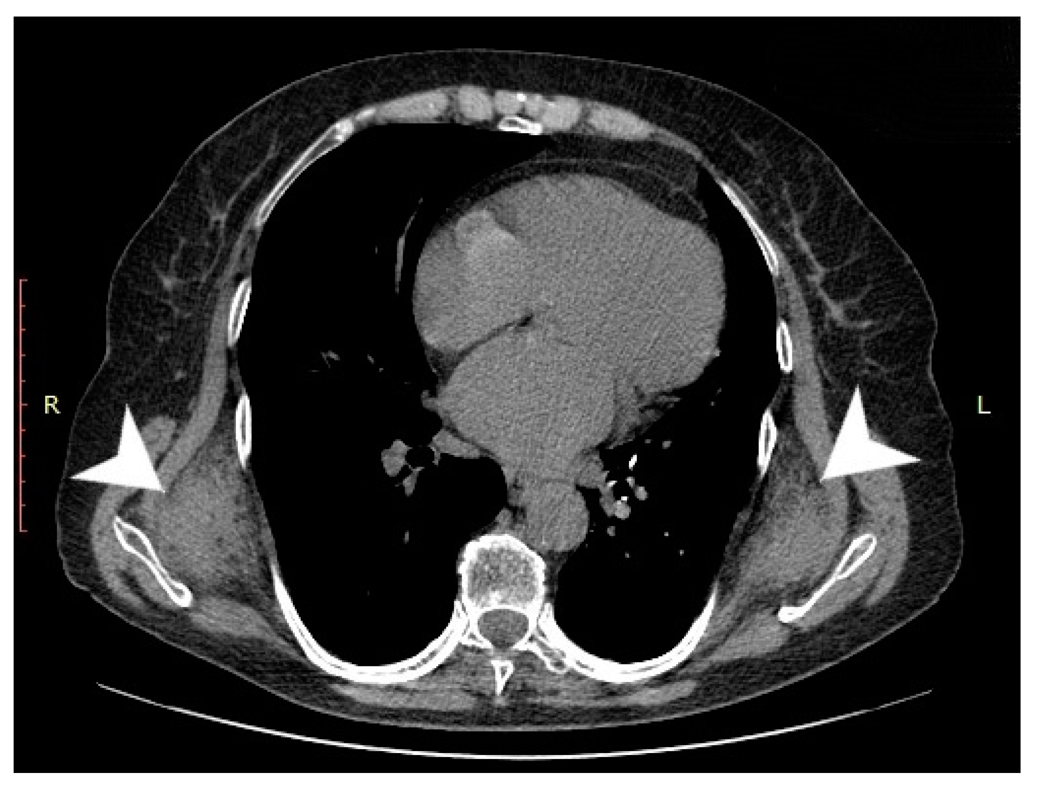 Medicina 57 00370 g001 Medicina 57 00370 g001