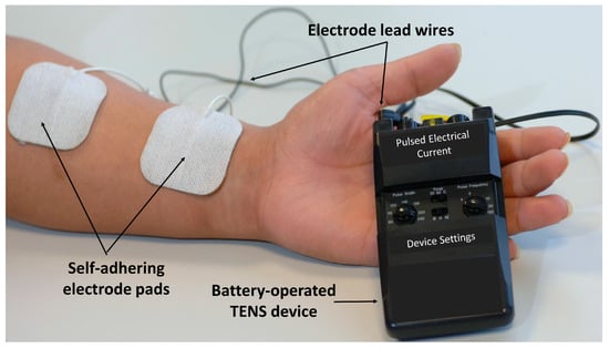 TENS Unit Placement 101: Insights into Effective Electrode Positioning