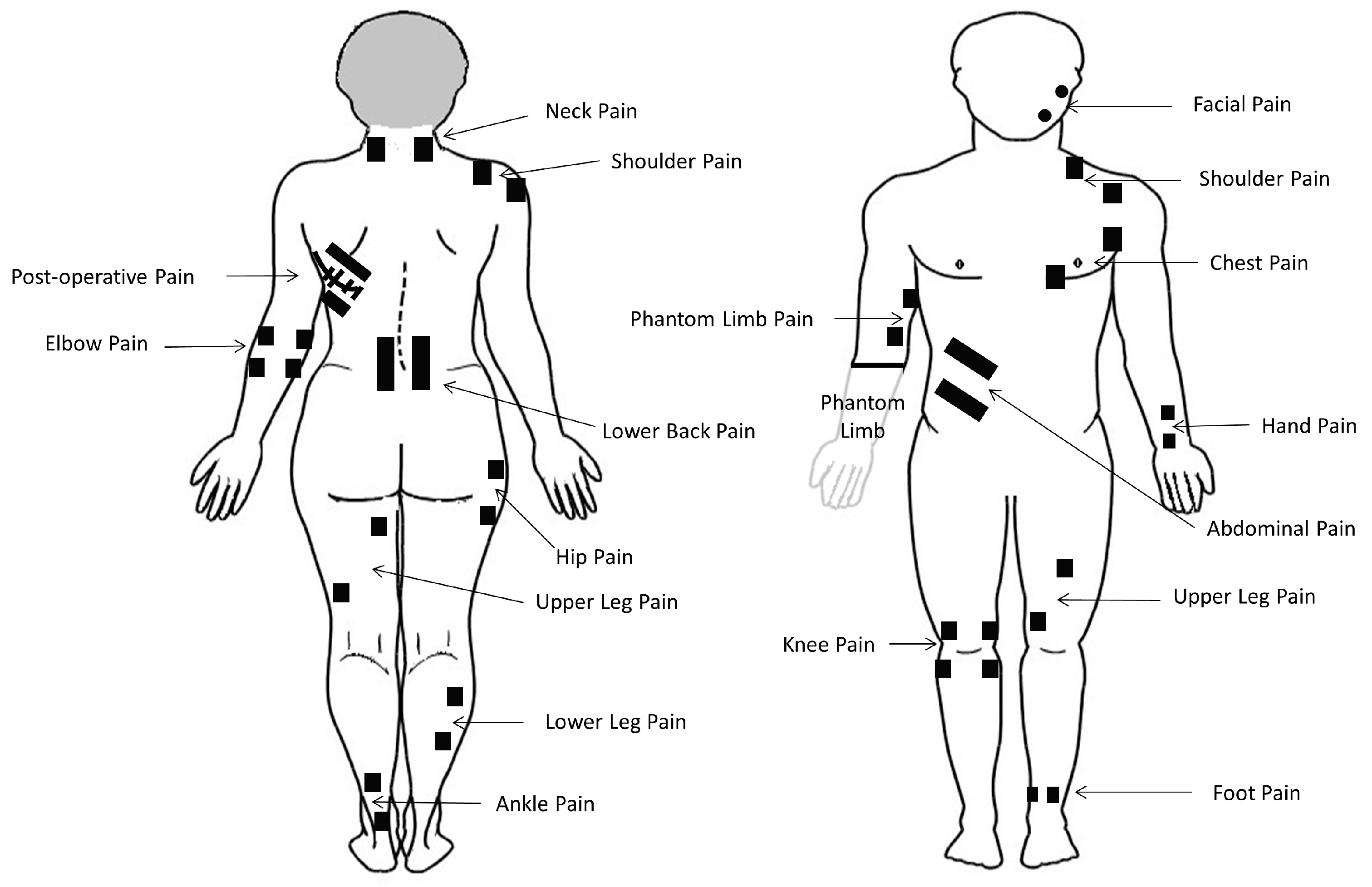 TENS Unit Electrode Placement Guide 