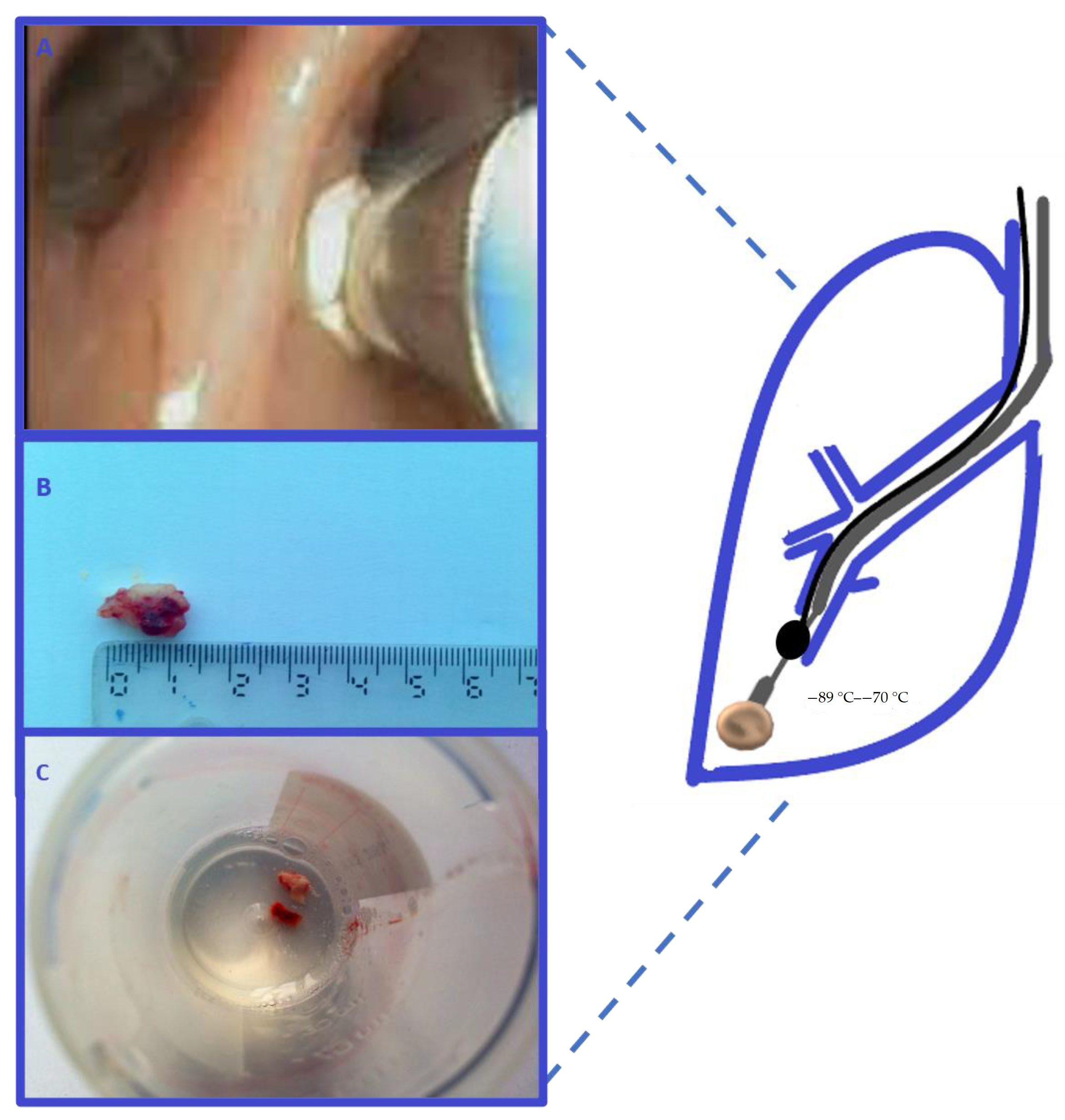 Medicina 57 00393 g002