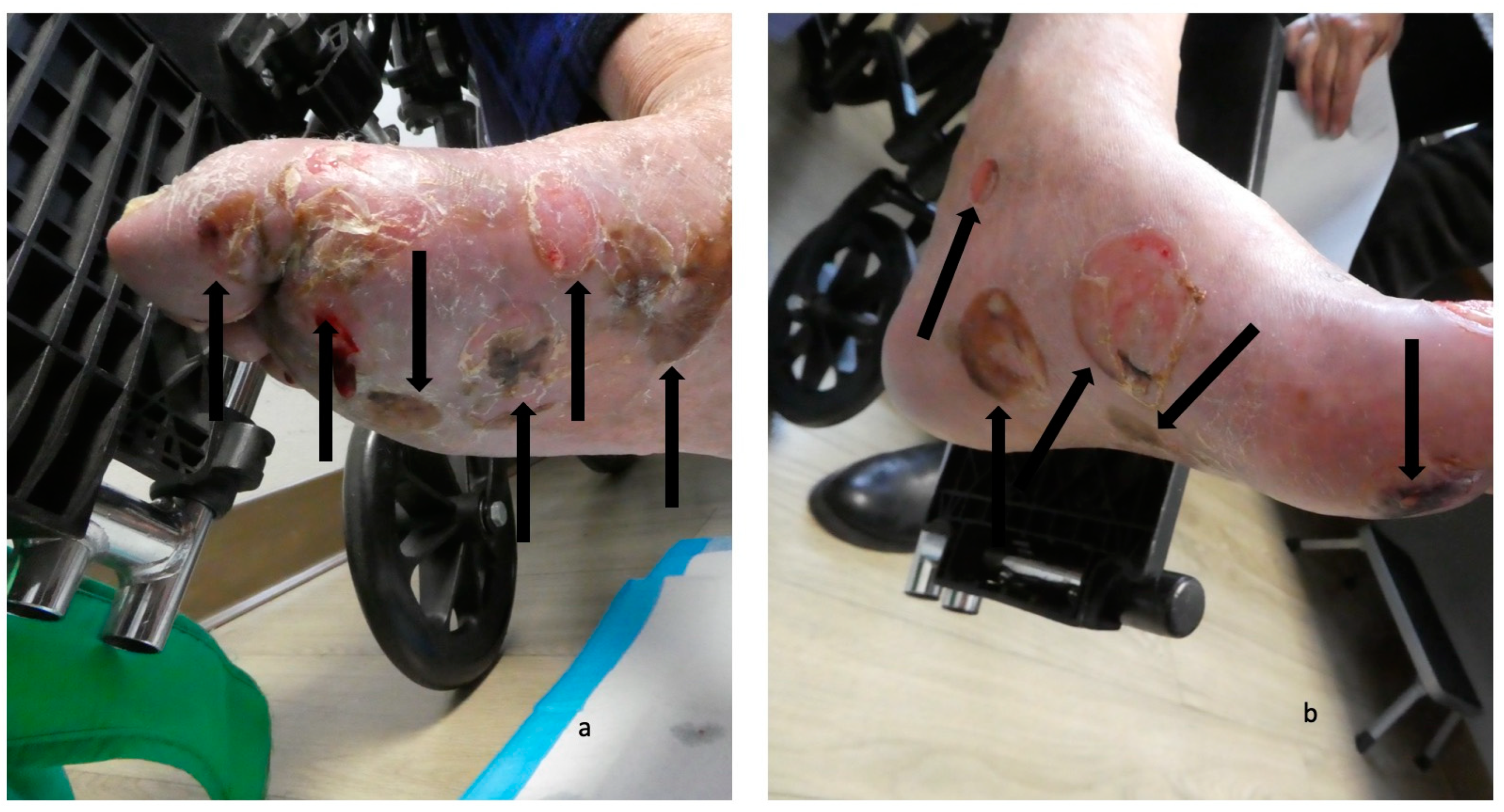 Medicina 57 00398 g004