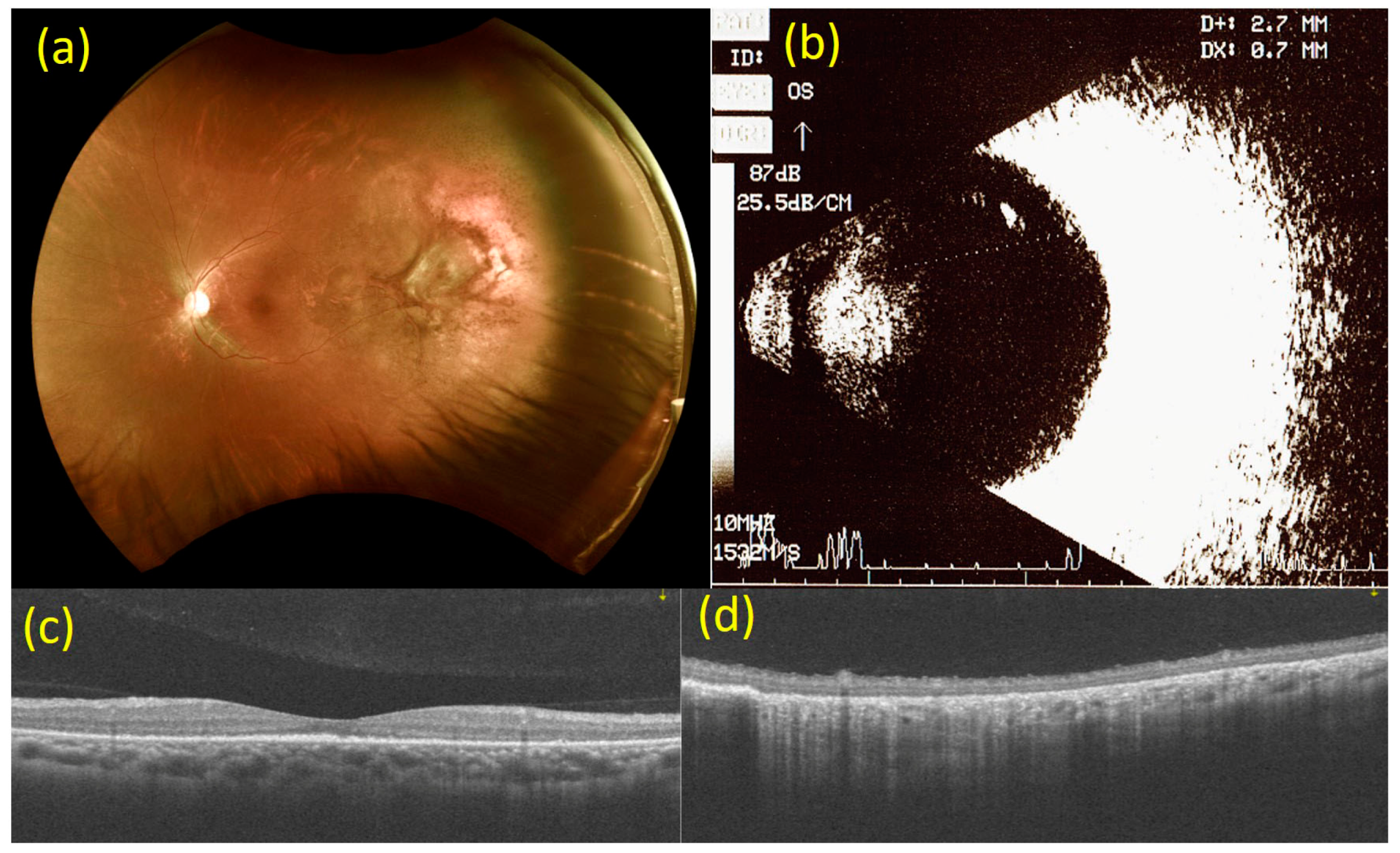 Medicina 57 00404 g003
