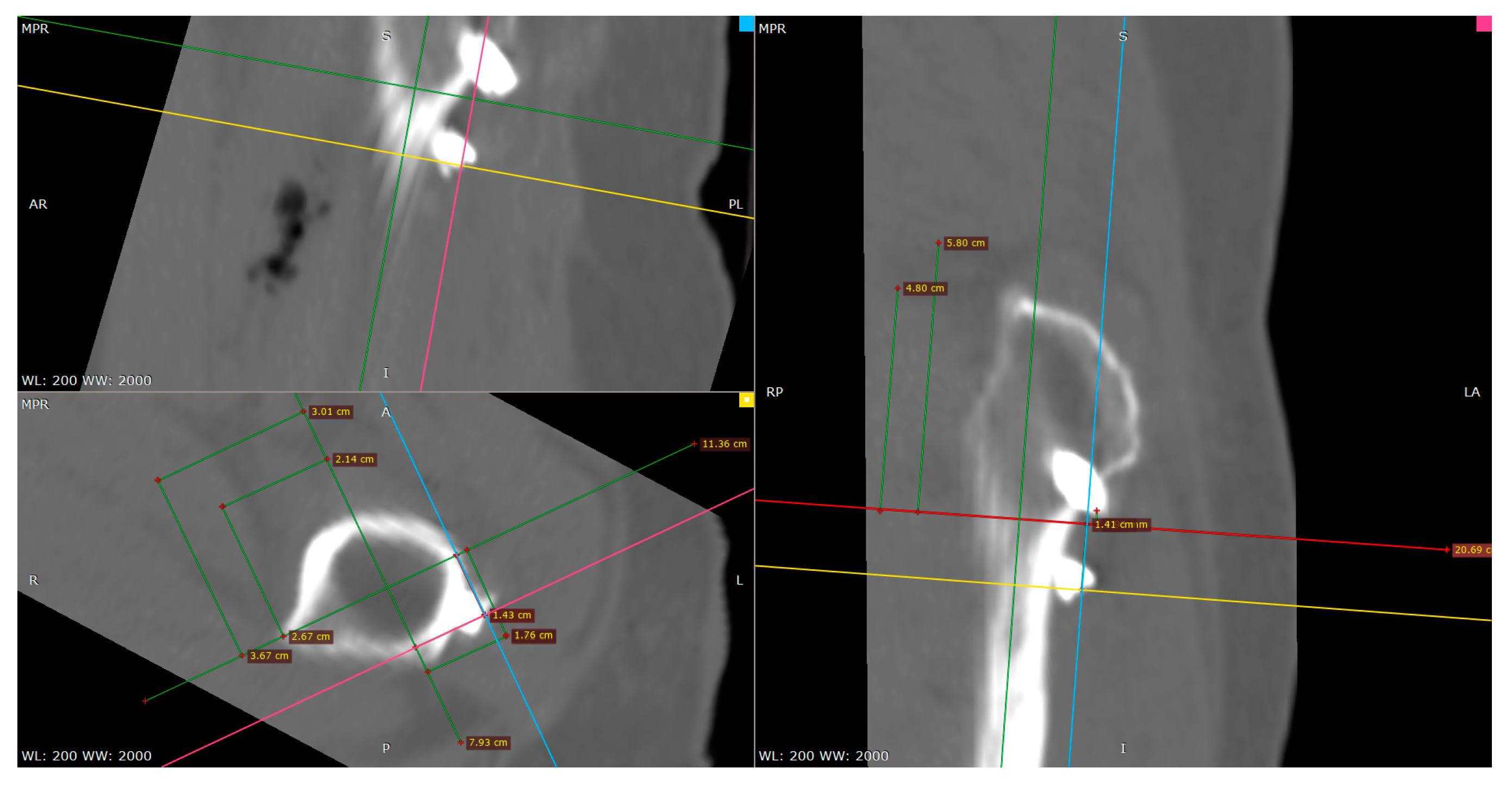 Medicina 57 00406 g011
