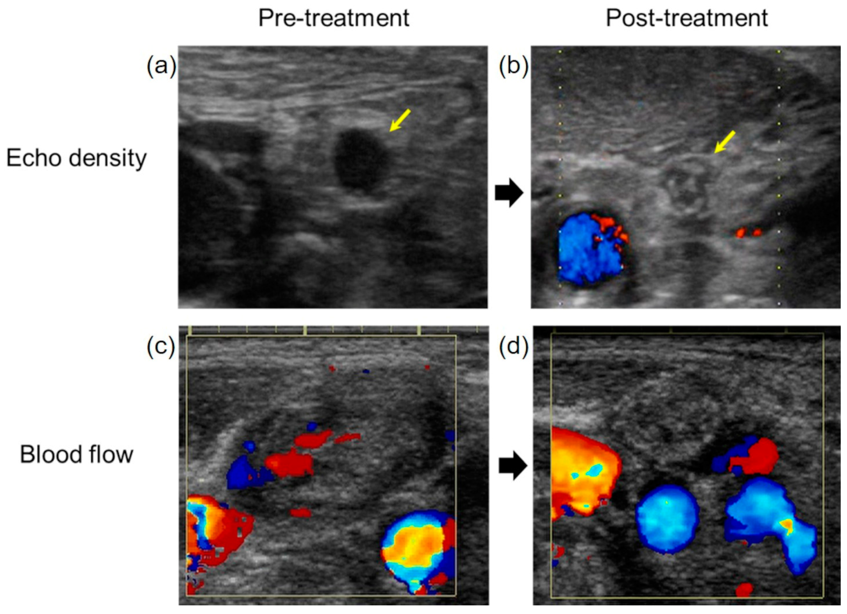 Medicina 57 00407 g005