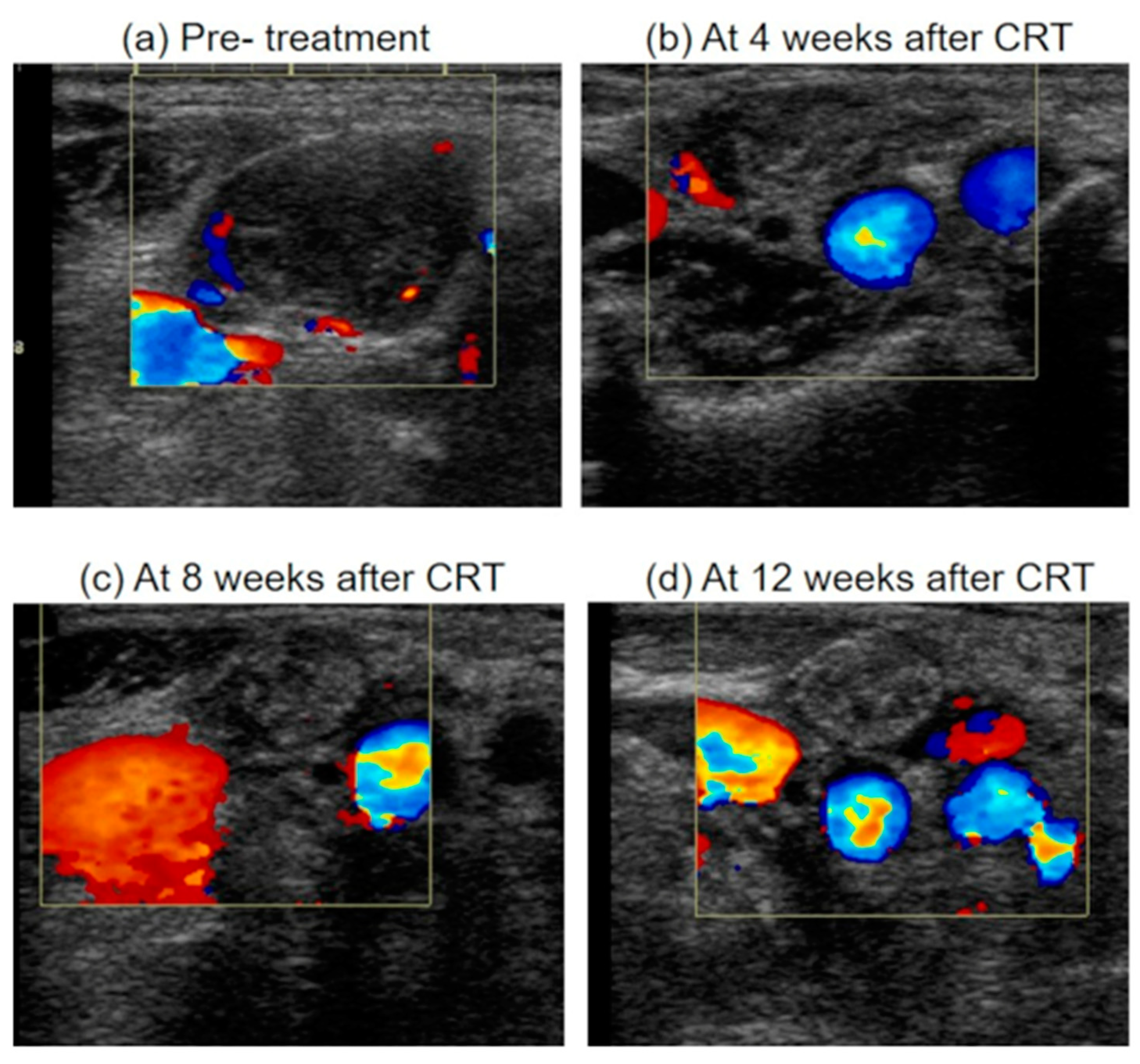 Medicina 57 00407 g006