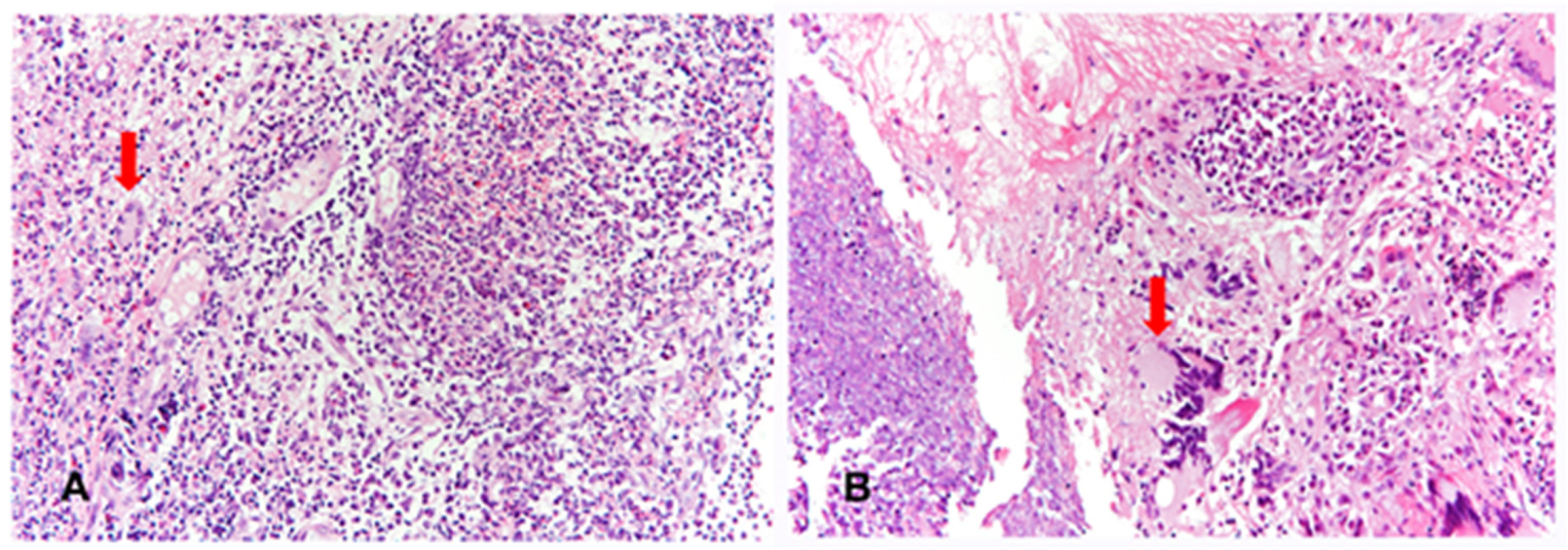Medicina 57 00423 g002