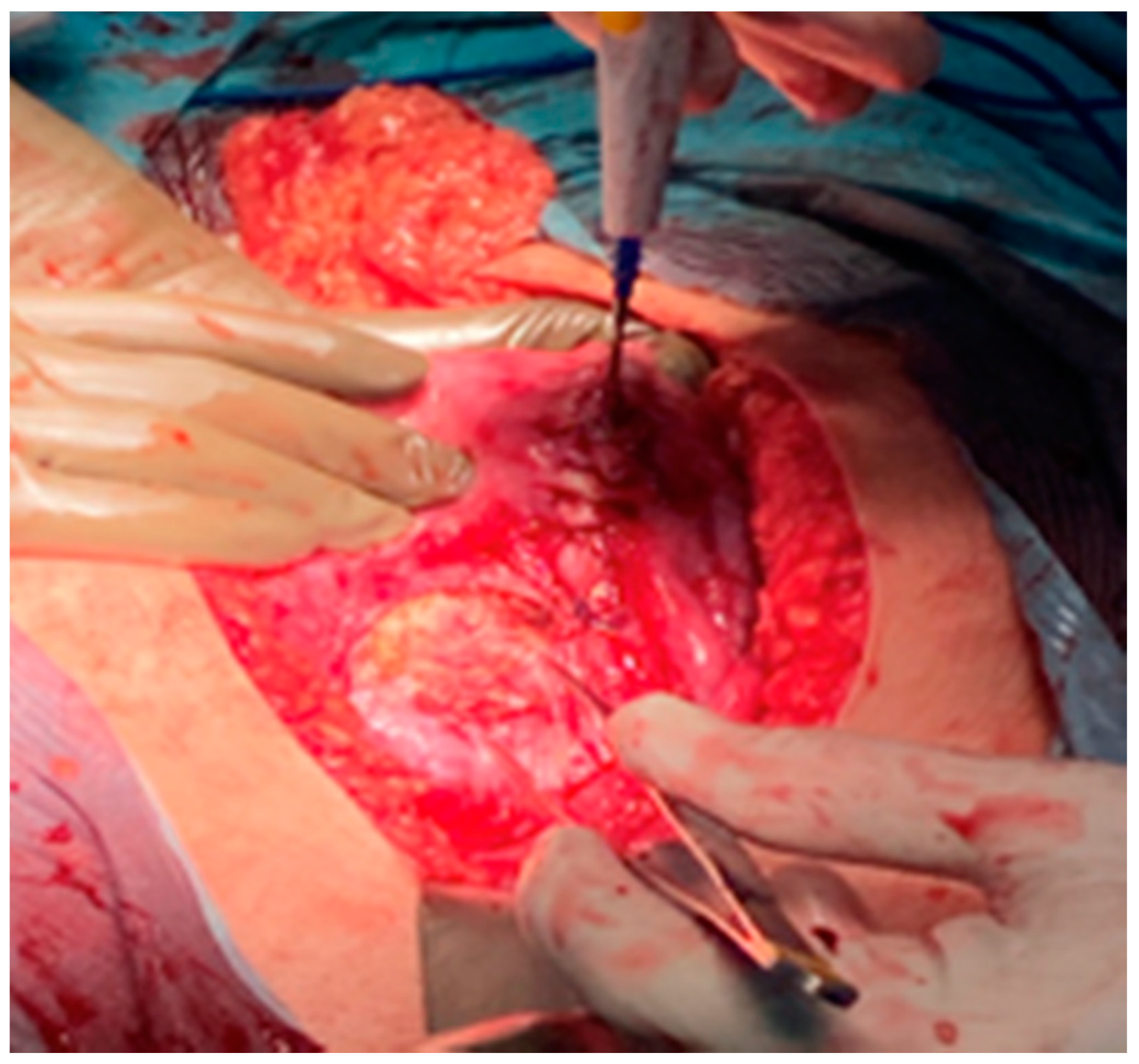 Medicina 57 00426 g005