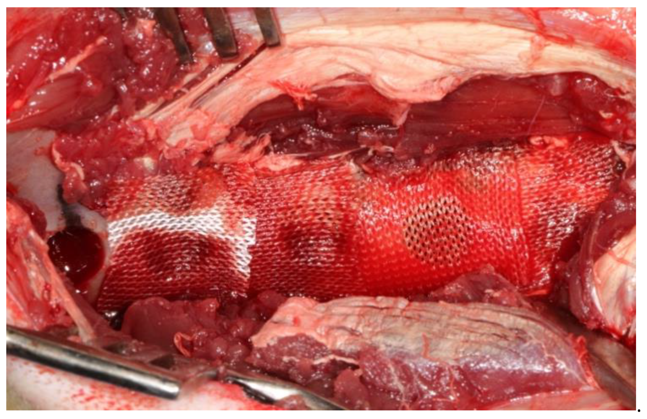 Medicina 57 00430 g004