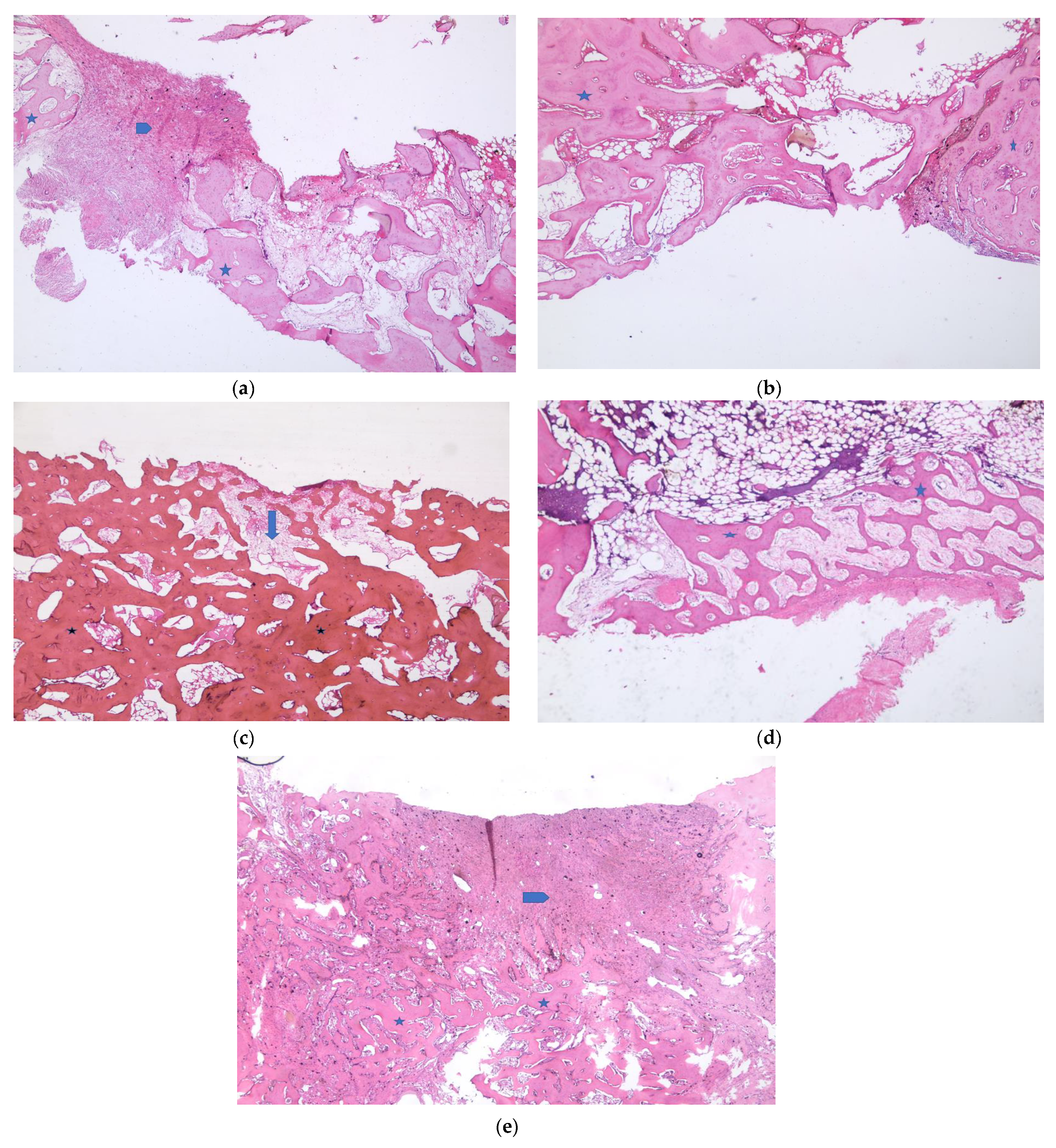Medicina 57 00430 g006