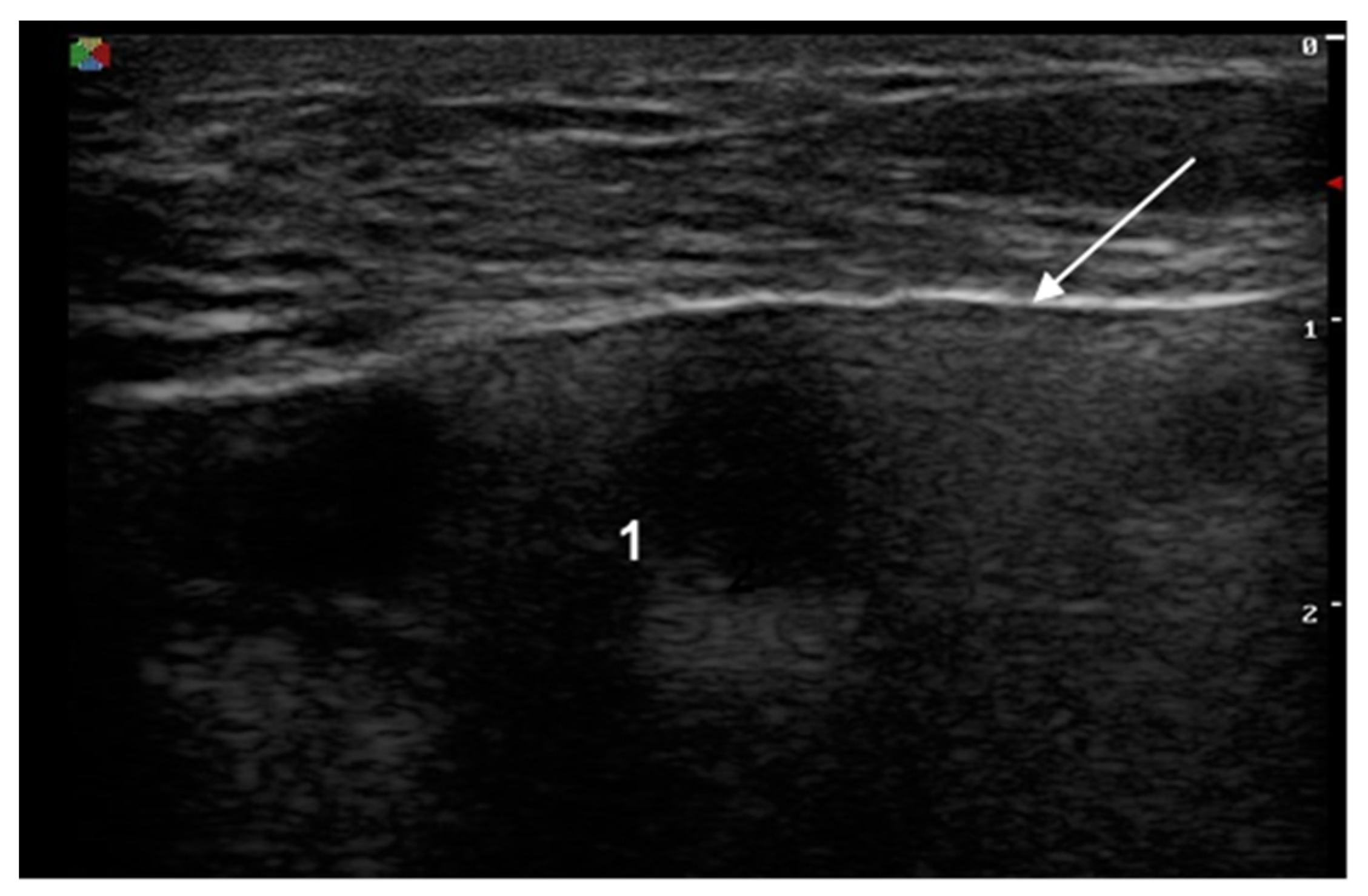 Medicina 57 00440 g002
