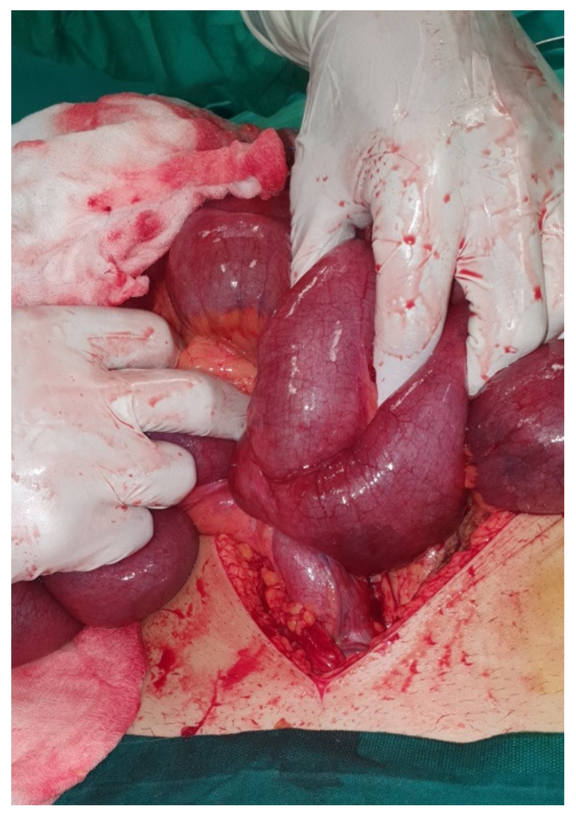 Medicina 57 00443 g001