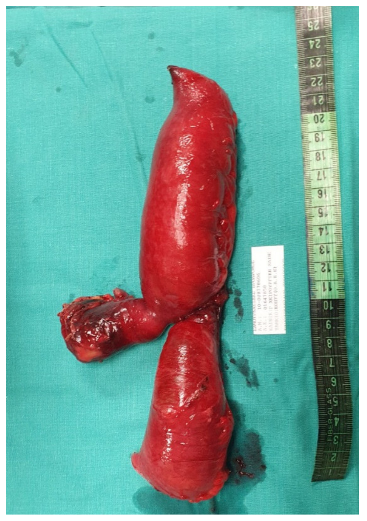 Medicina 57 00443 g002