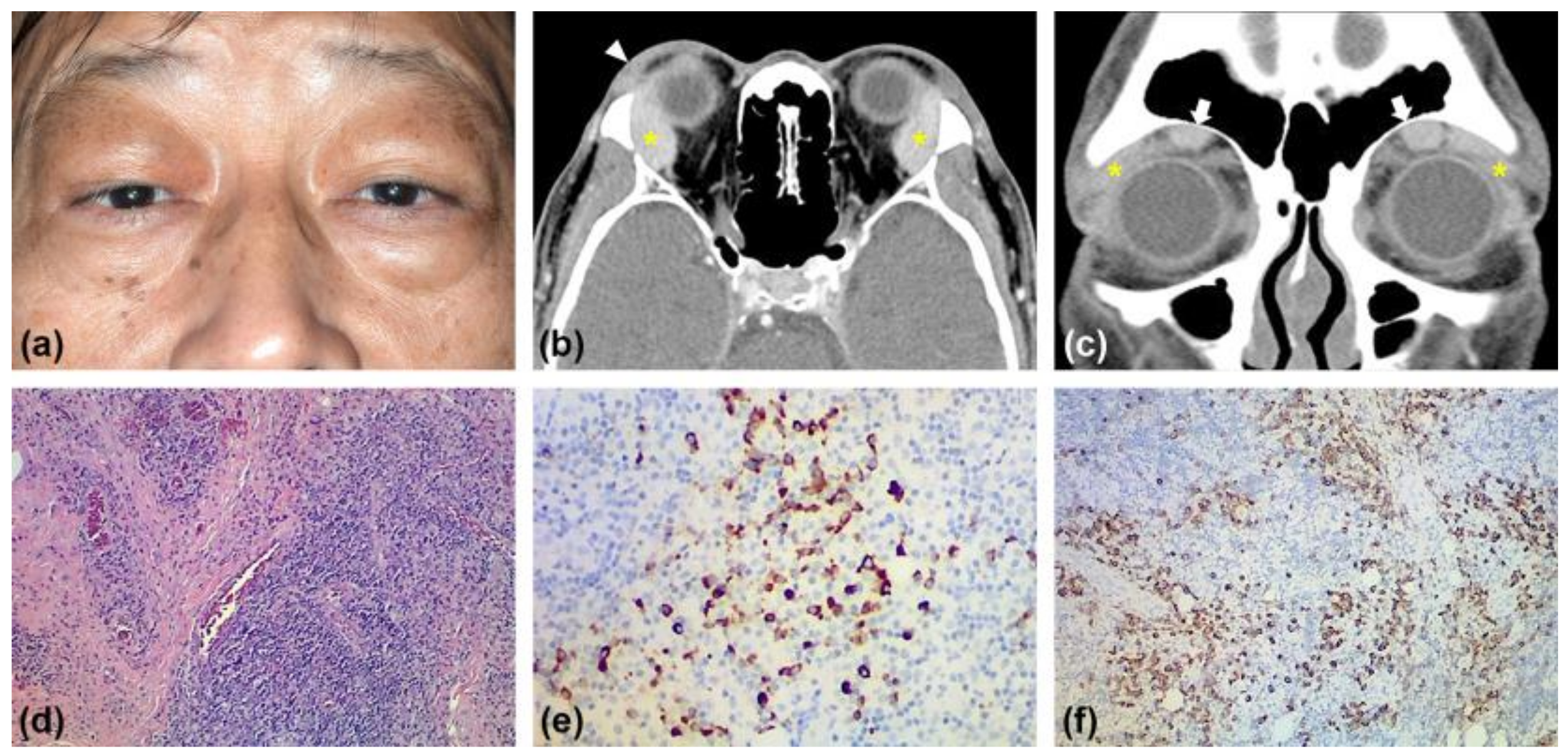 Medicina 57 00448 g001 Medicina 57 00448 g001