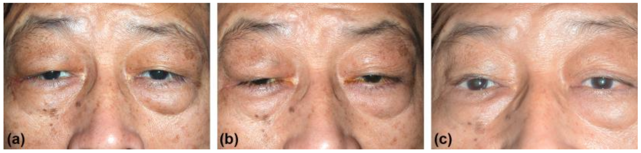 Medicina 57 00448 g002 Medicina 57 00448 g002