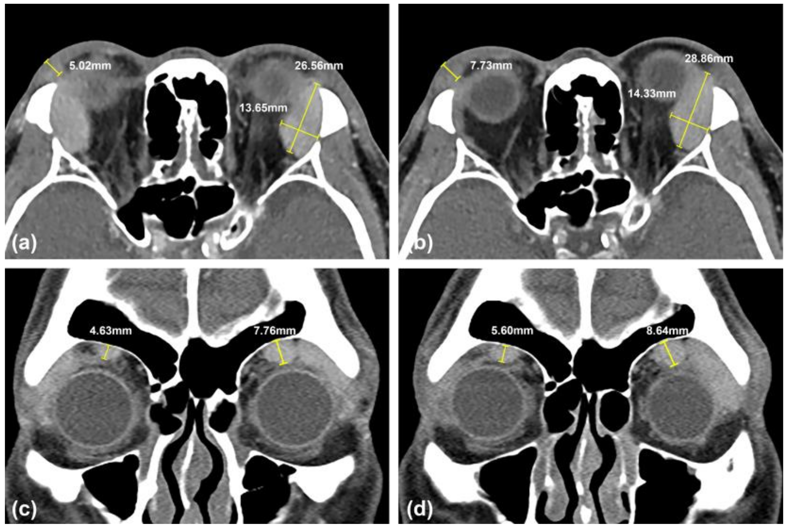 Medicina 57 00448 g003 Medicina 57 00448 g003
