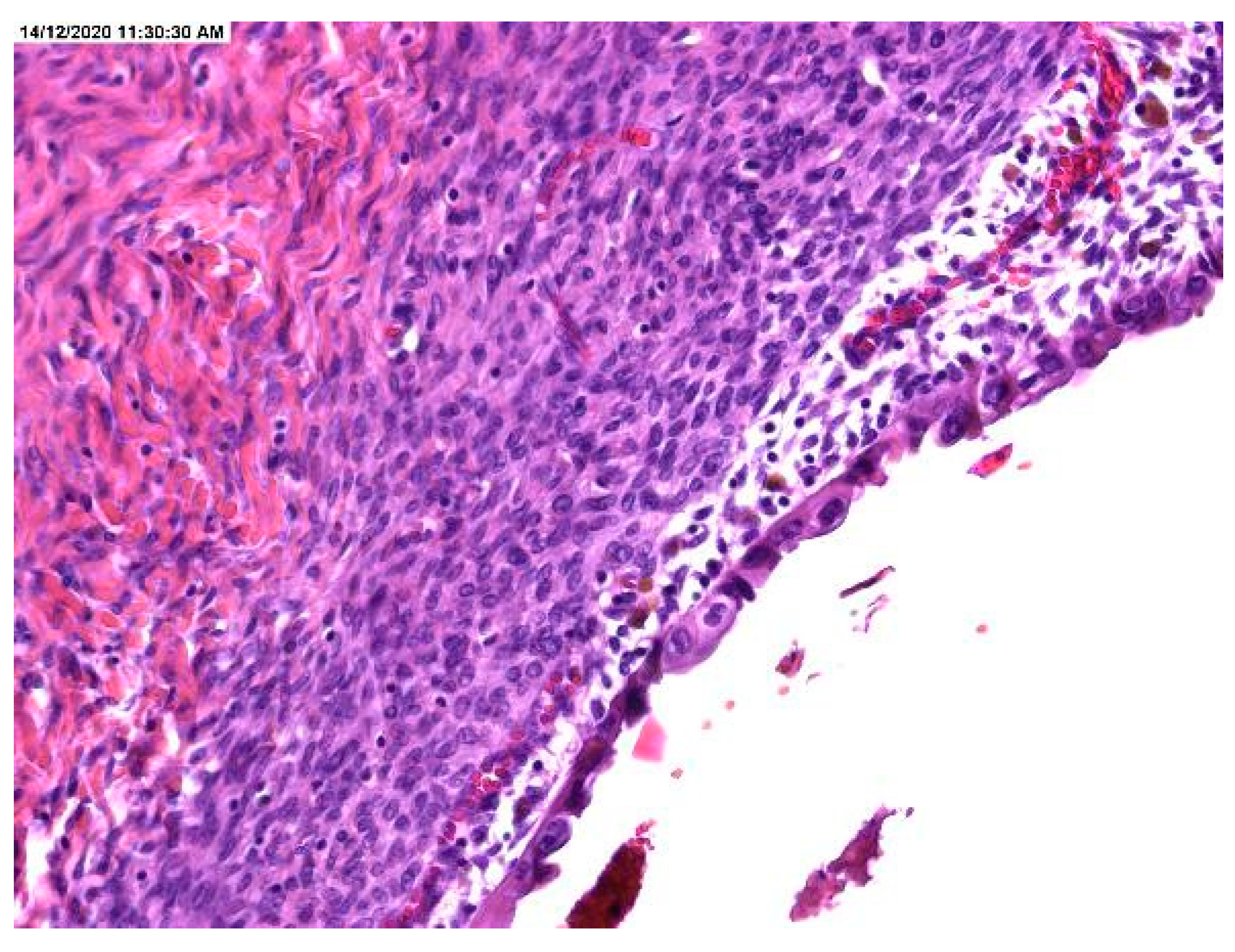 Medicina Free FullText Clinical and Pathological Significance of