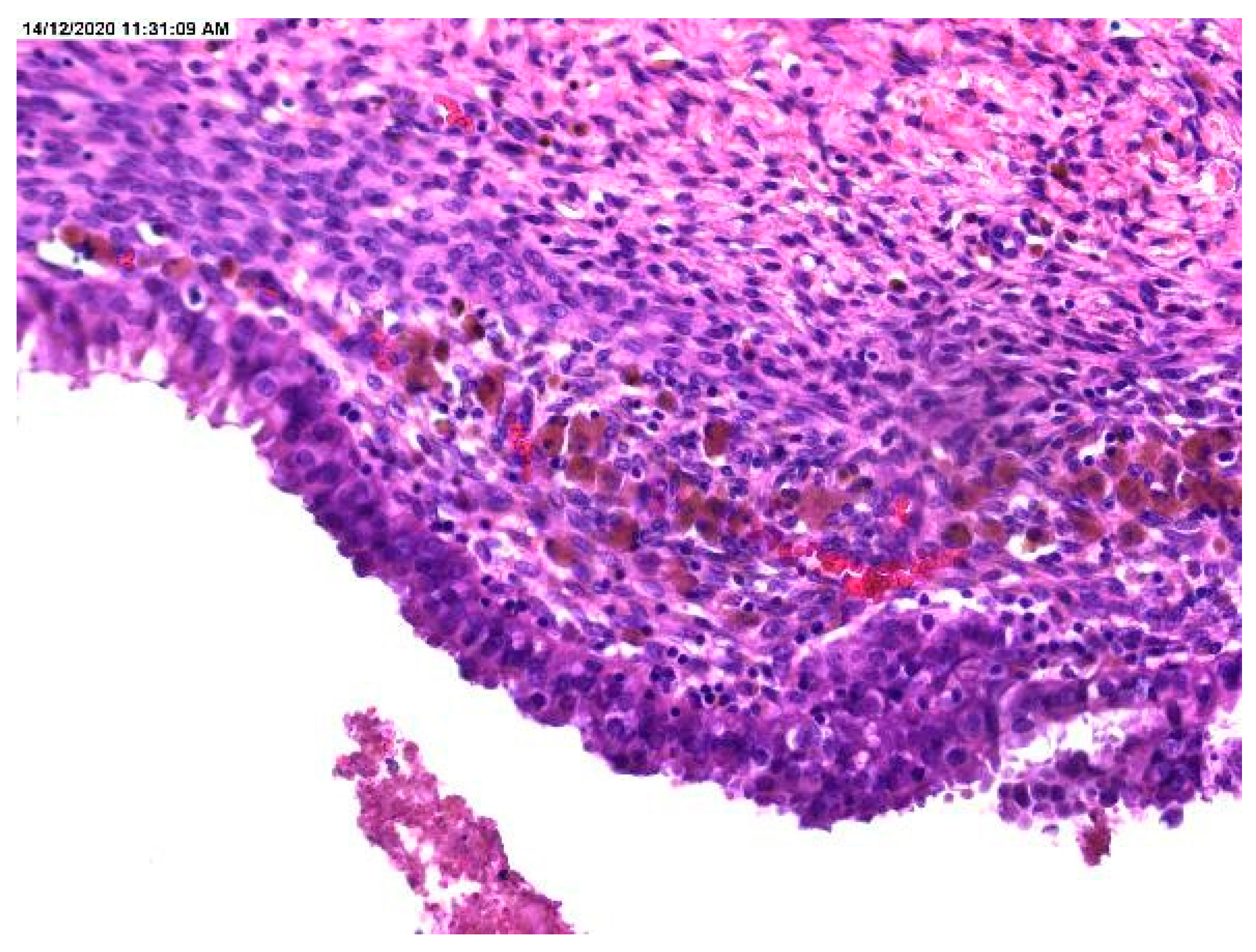 Medicina 57 00453 g002