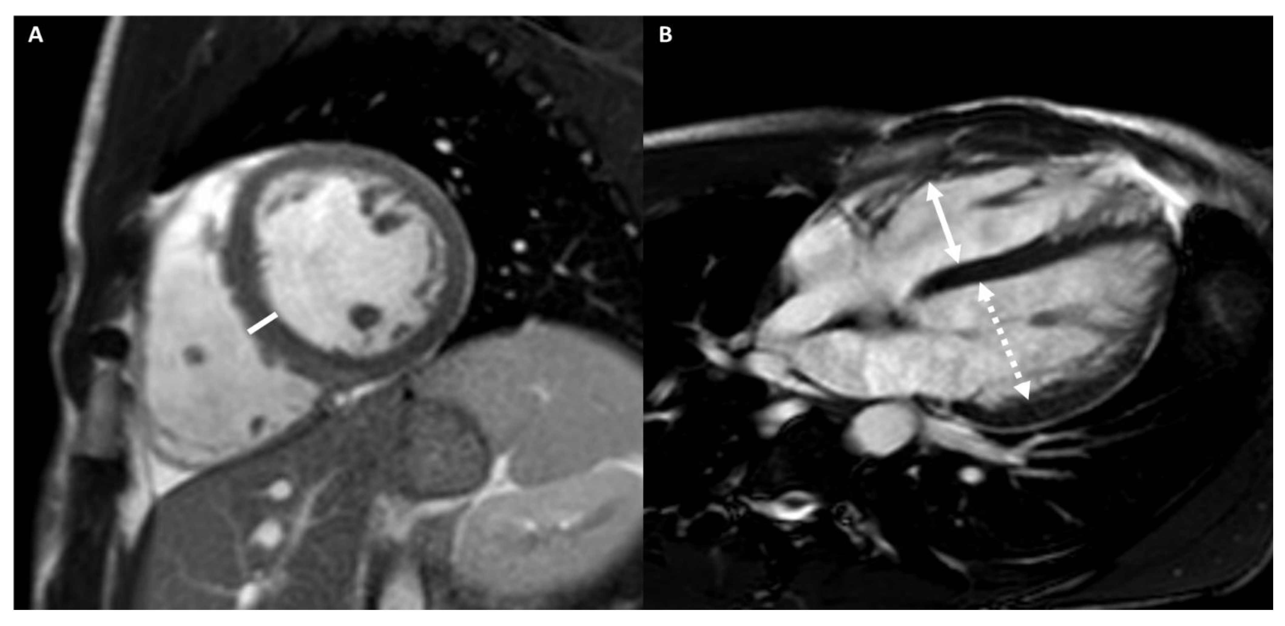 Medicina 57 00455 g001a Medicina 57 00455 g001a