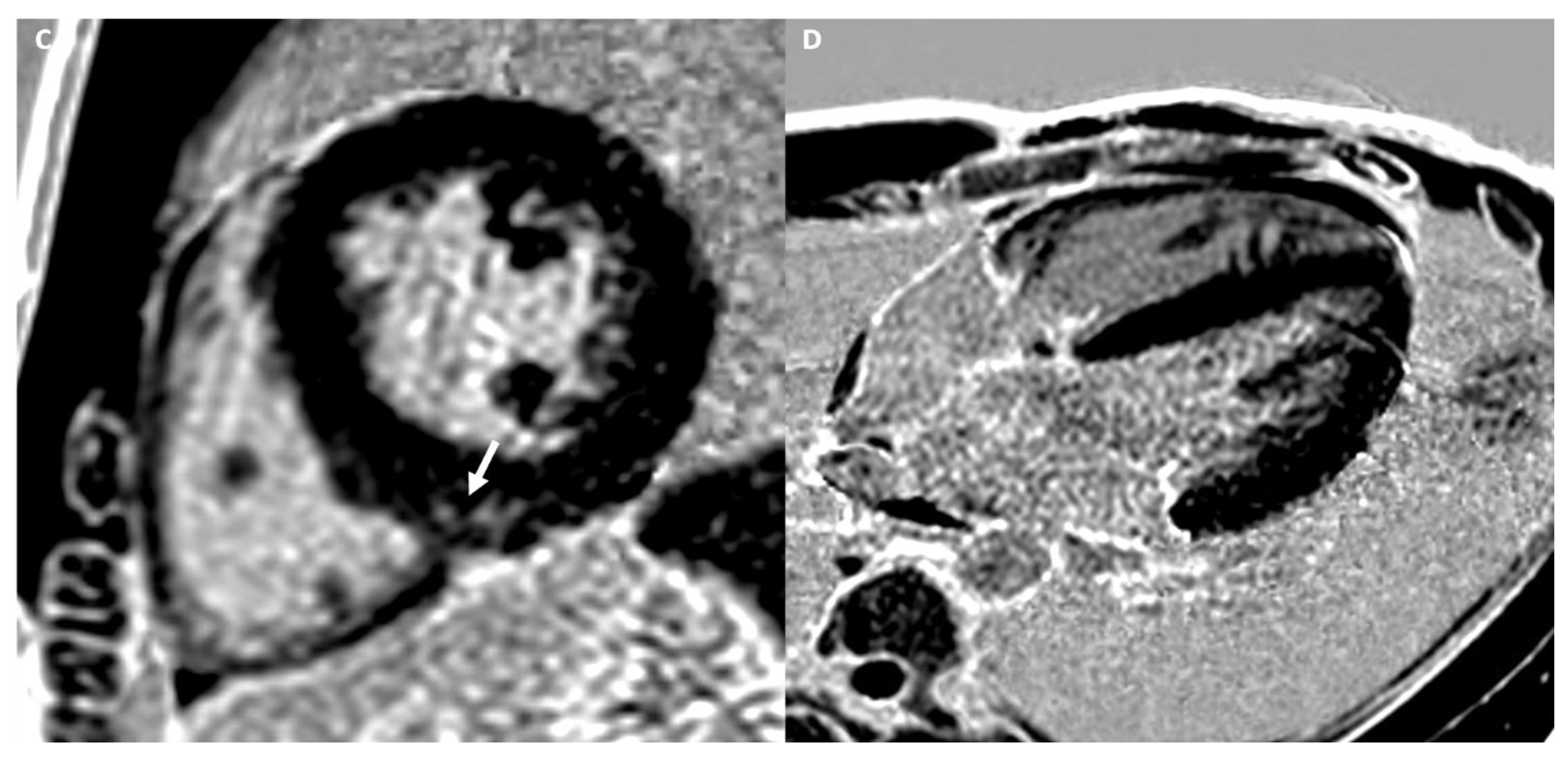 Medicina 57 00455 g001b Medicina 57 00455 g001b