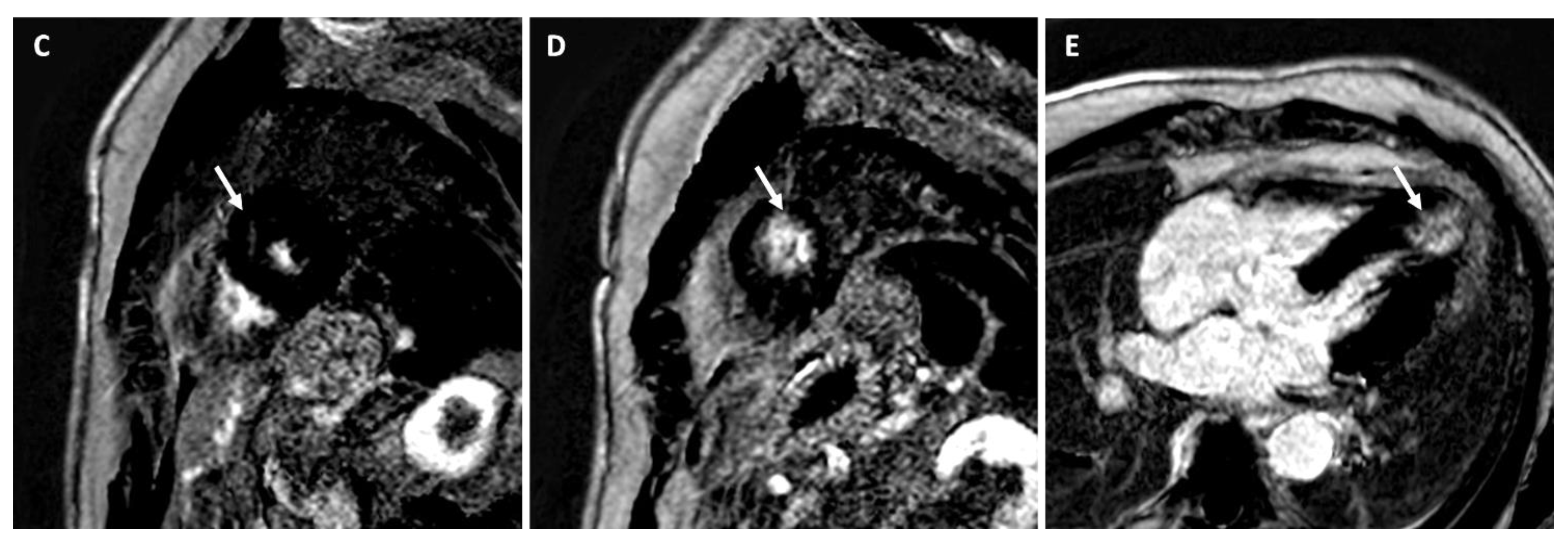 Medicina 57 00455 g002b Medicina 57 00455 g002b