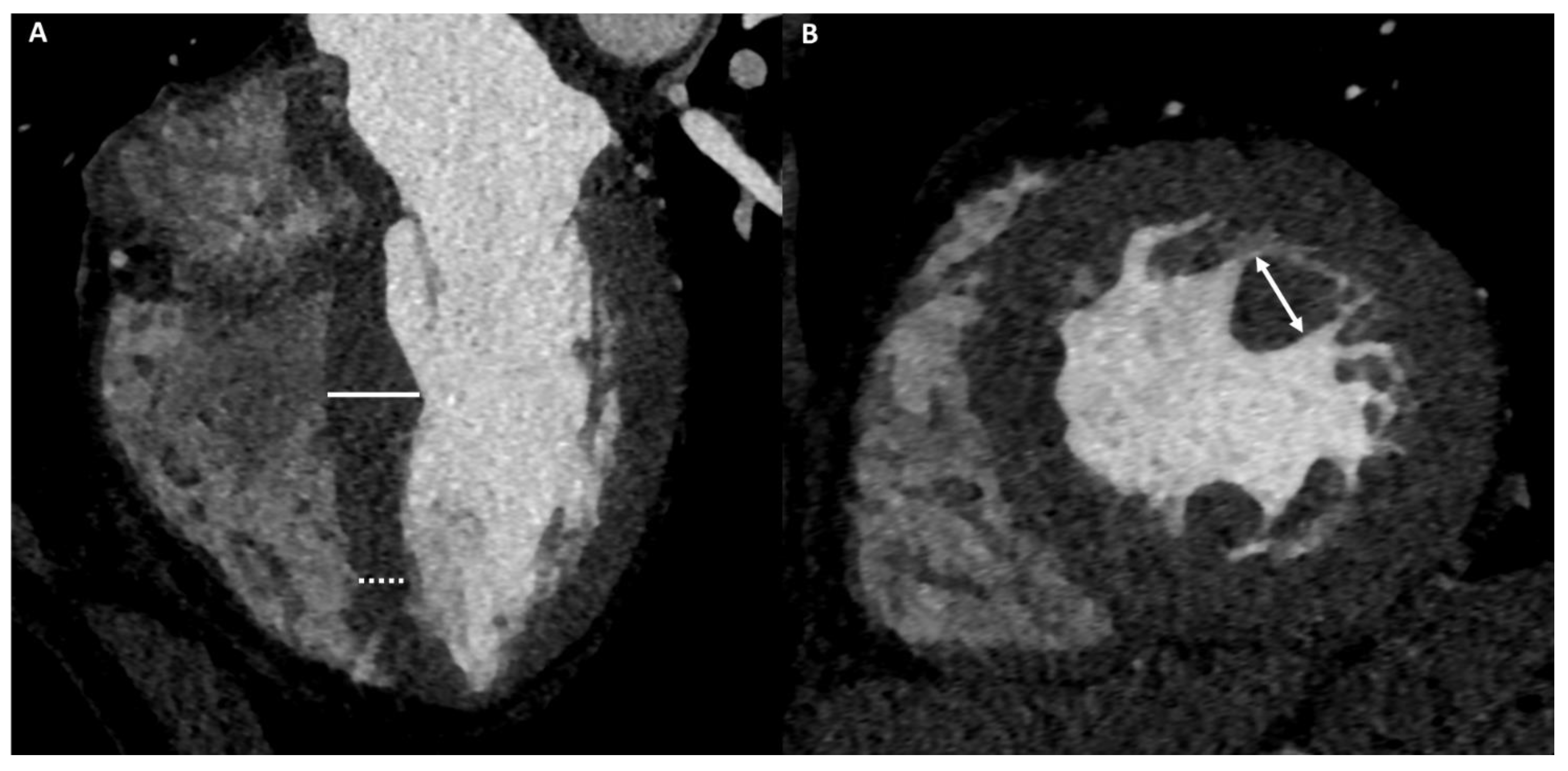 Medicina 57 00455 g003a Medicina 57 00455 g003a