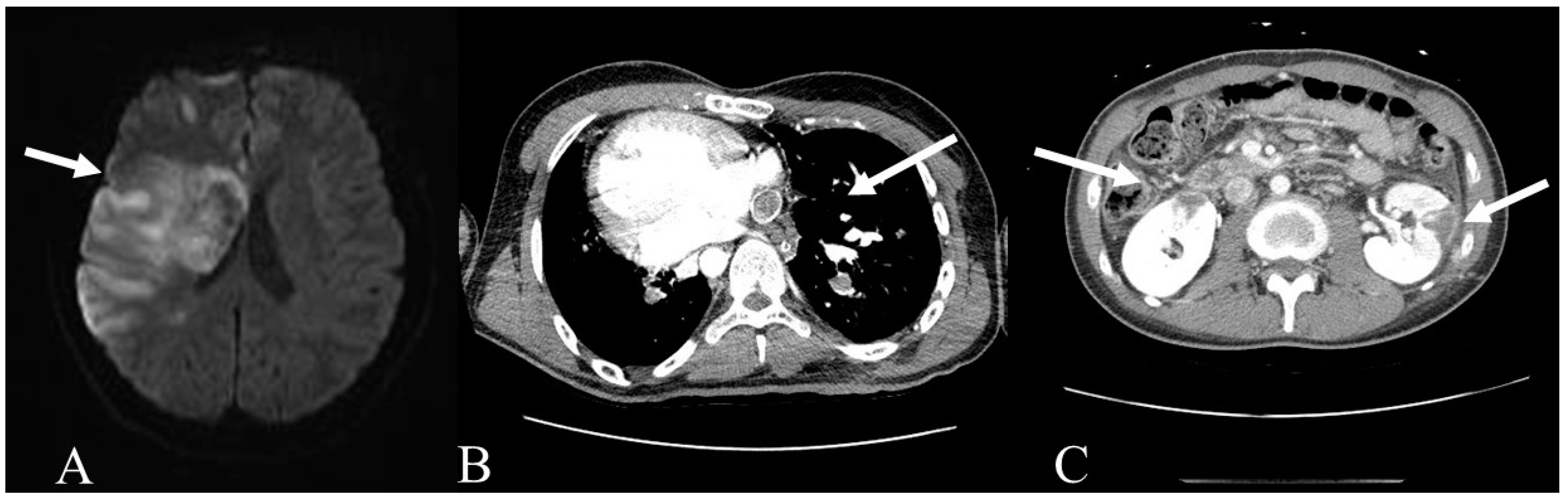 Medicina 57 00465 g001