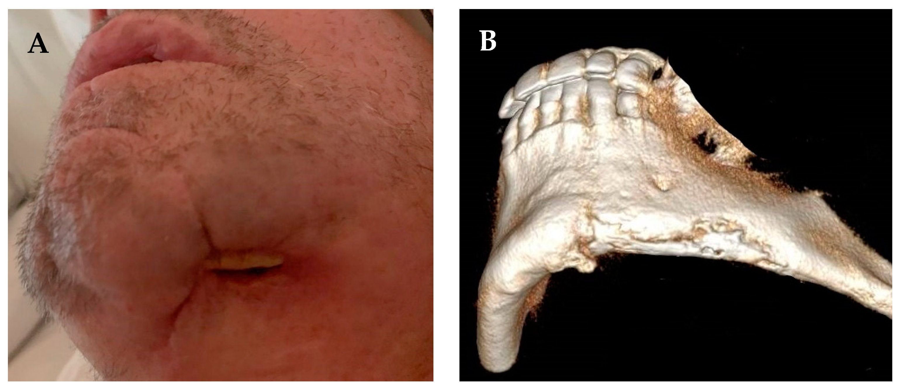 Medicina 57 00468 g001