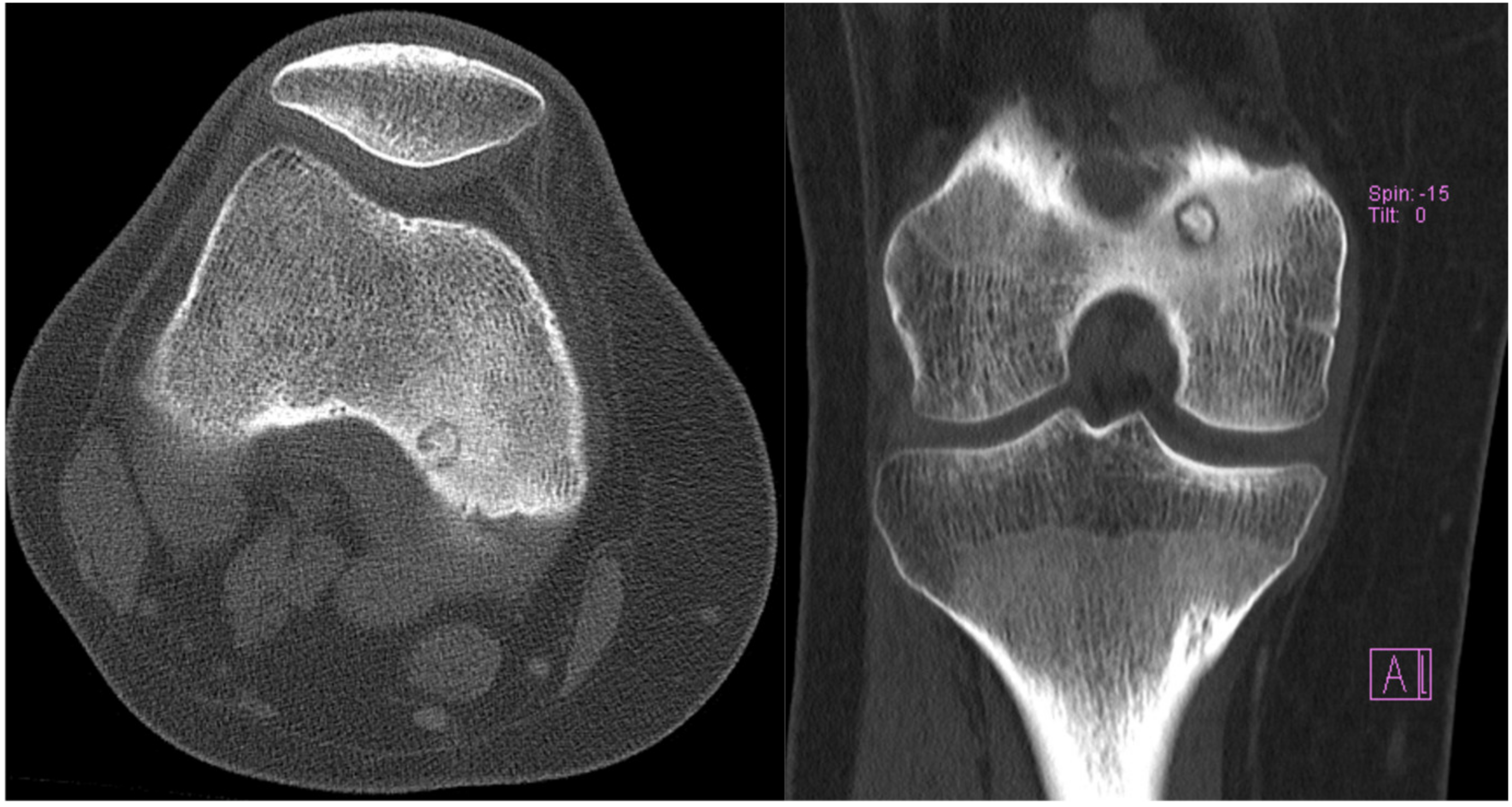 Medicina 57 00470 g002 Medicina 57 00470 g002