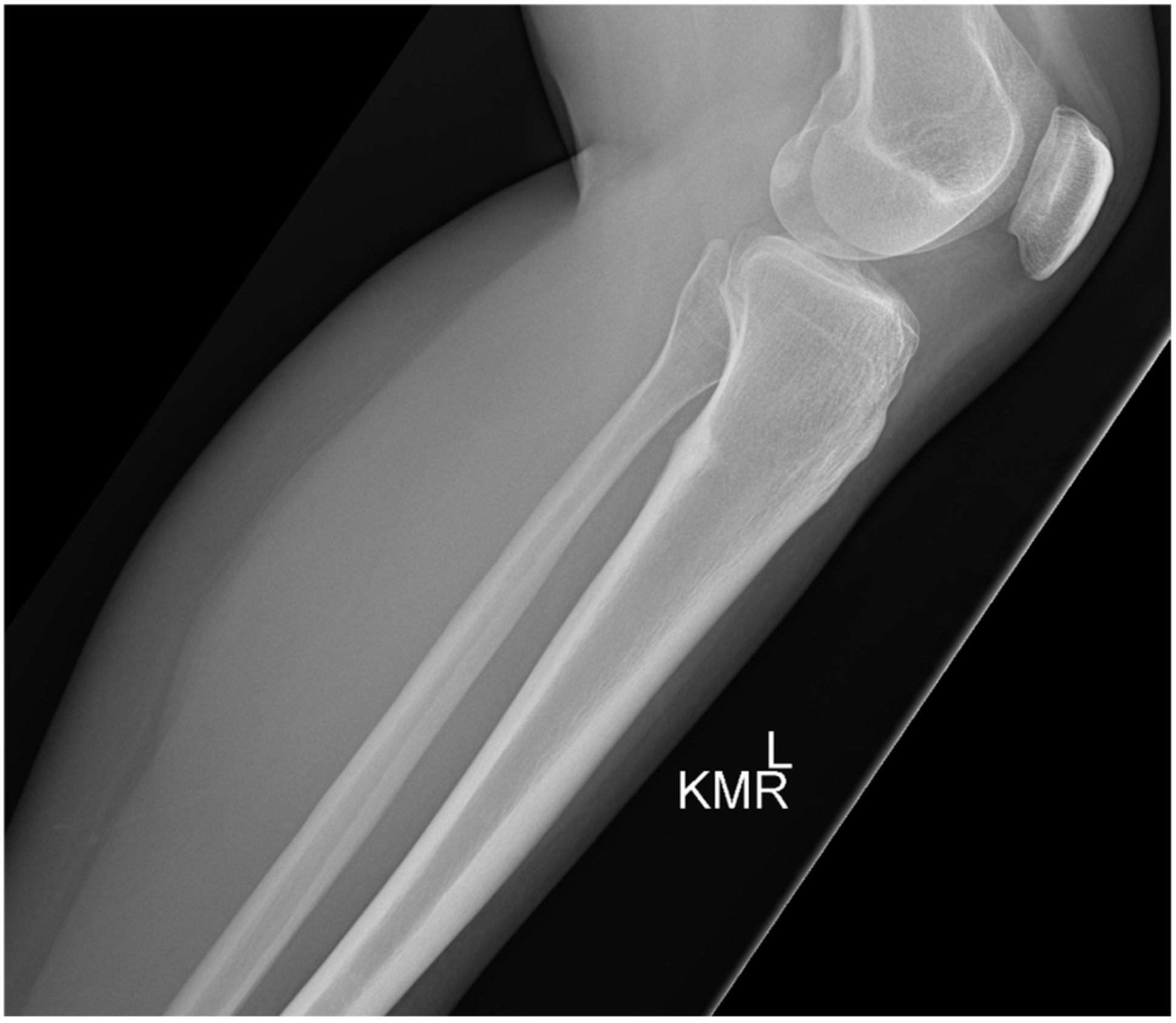 Medicina 57 00470 g003 Medicina 57 00470 g003