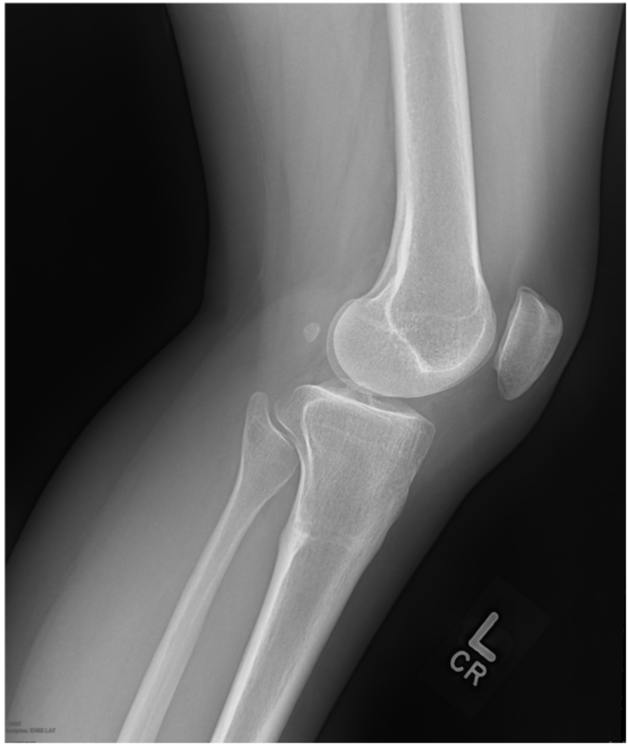 Medicina 57 00470 g005 Medicina 57 00470 g005