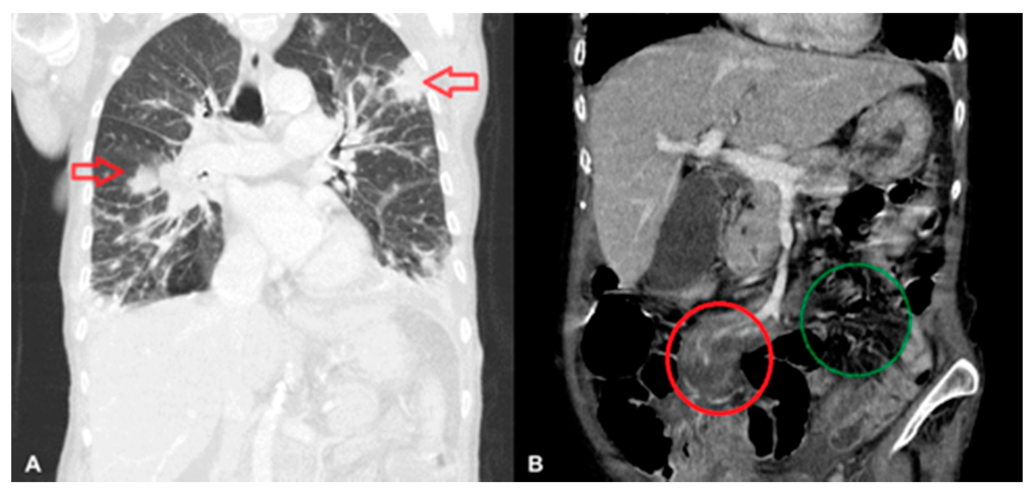 Medicina 57 00471 g001