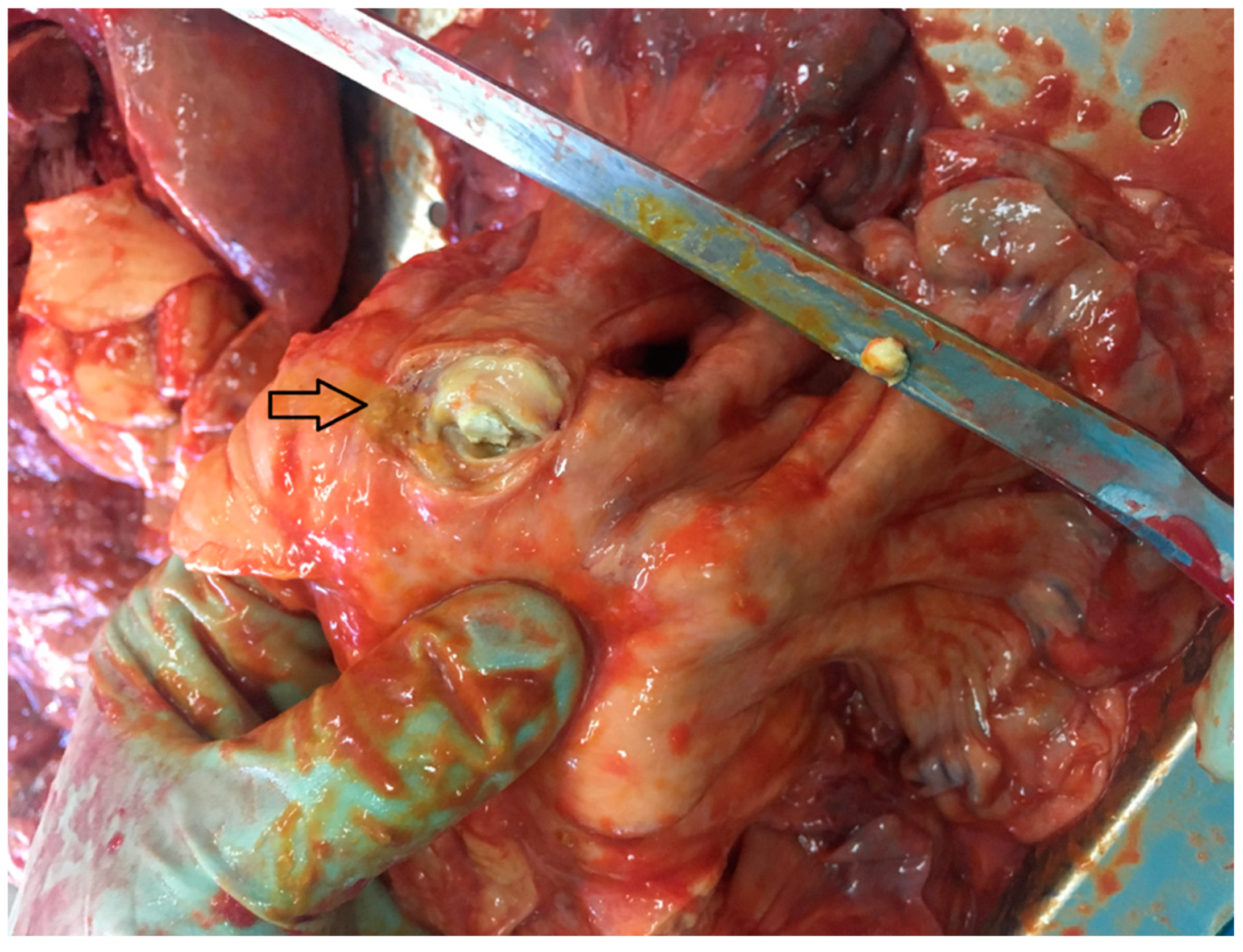 Medicina 57 00471 g003