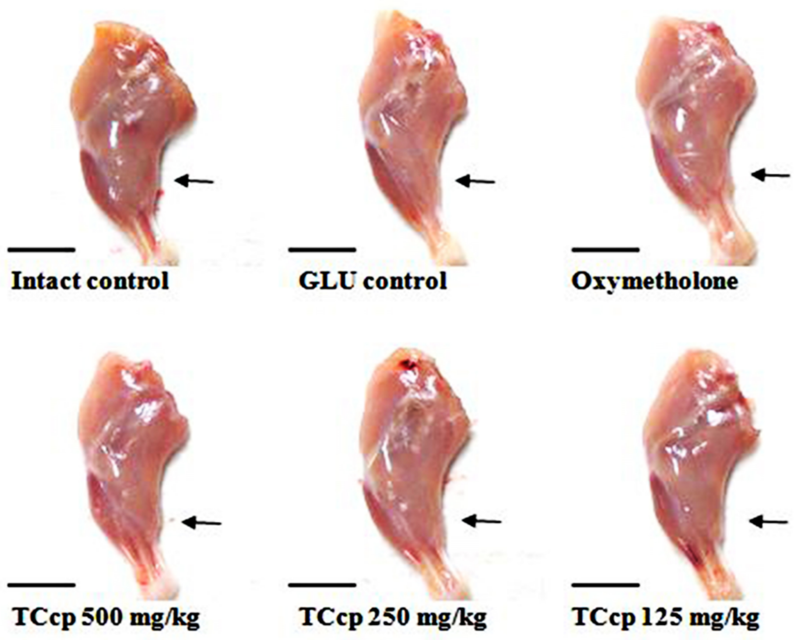 Medicina 57 00485 g003