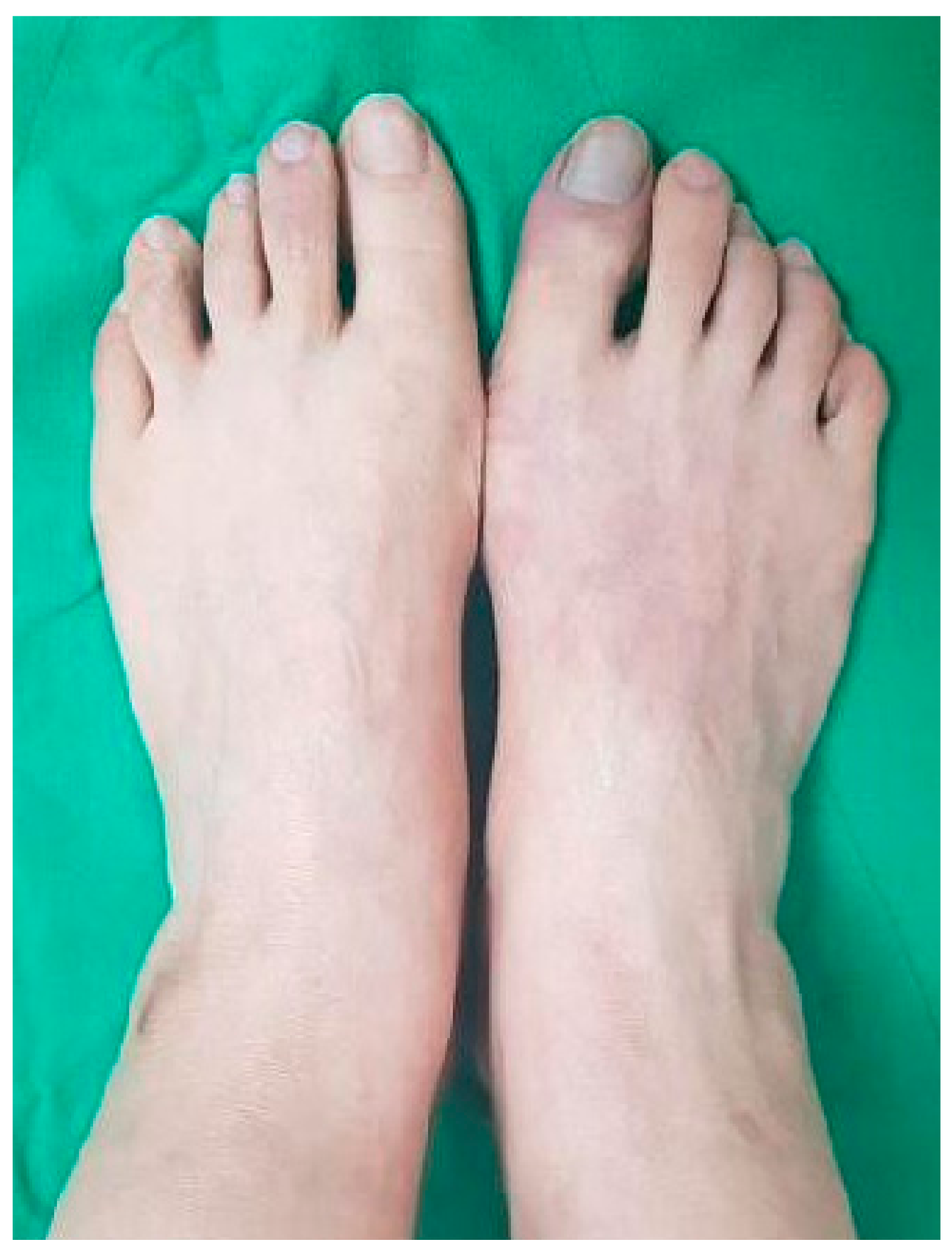 Medicina 57 00486 g001