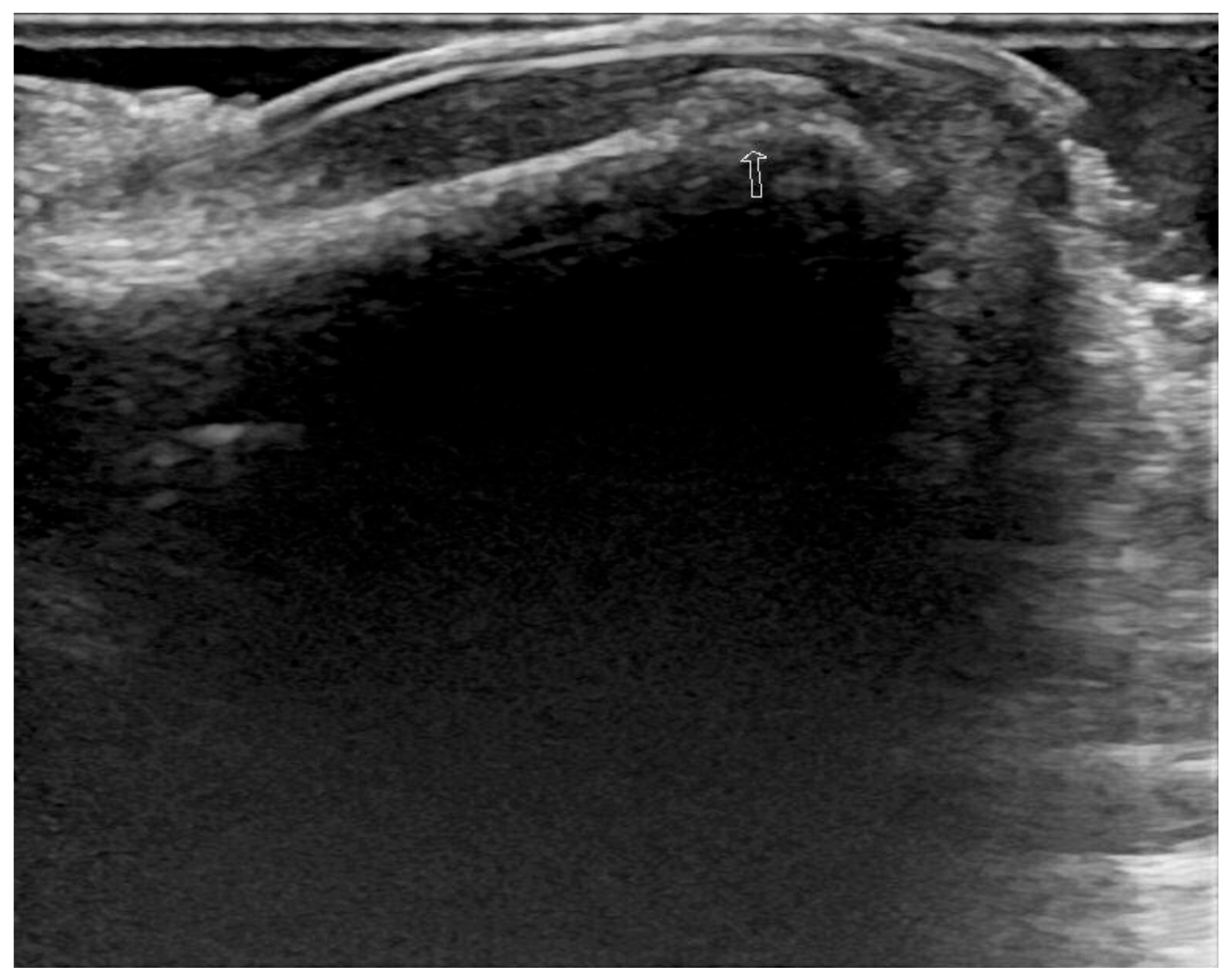 Medicina 57 00486 g002