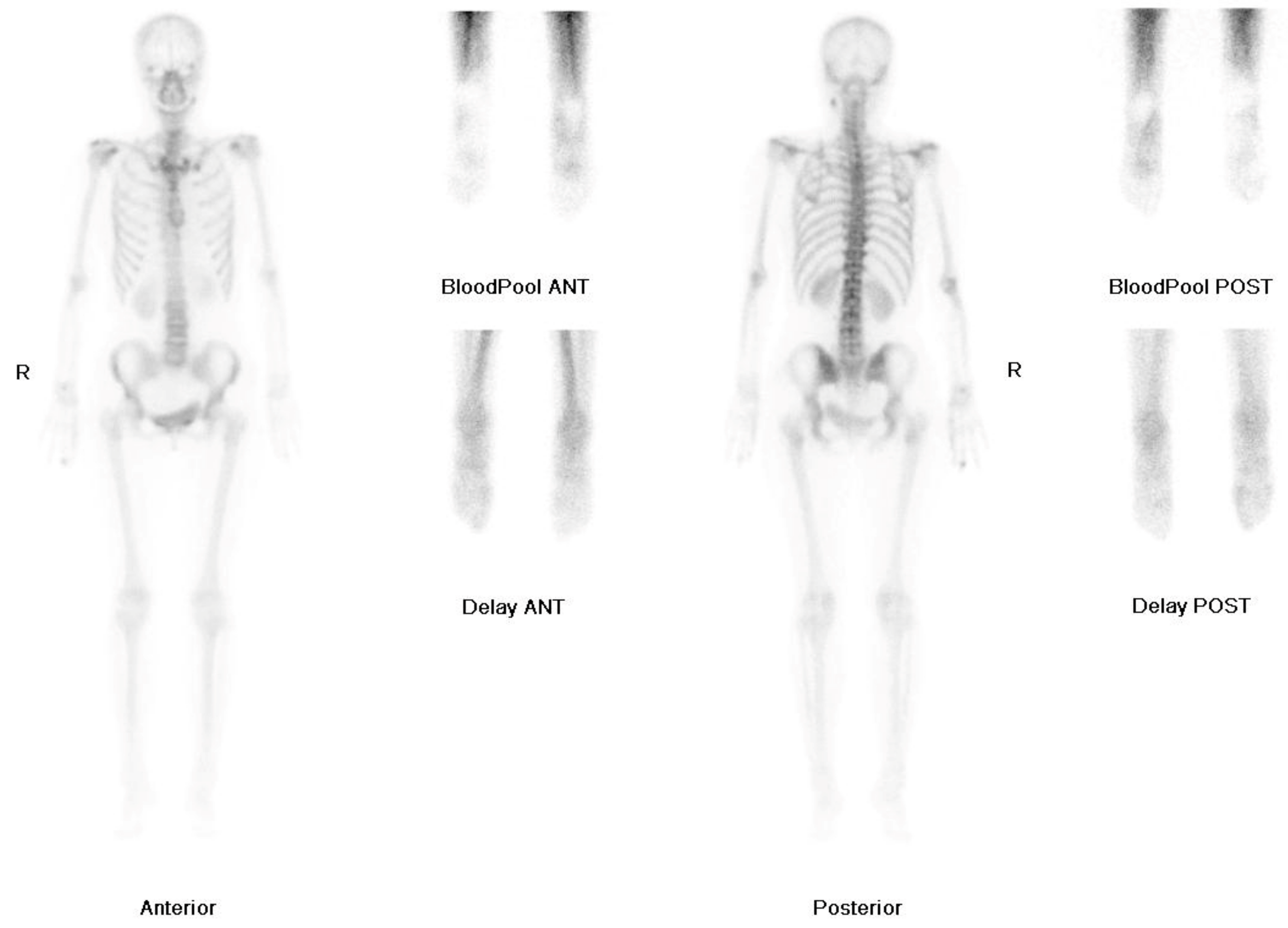 Medicina 57 00486 g003