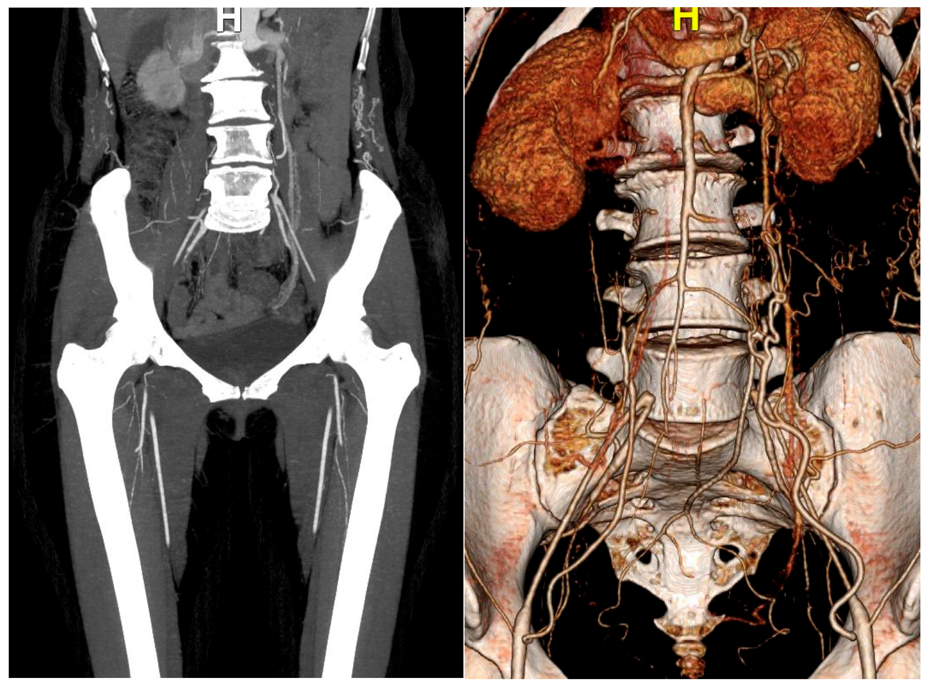 Medicina 57 00486 g004