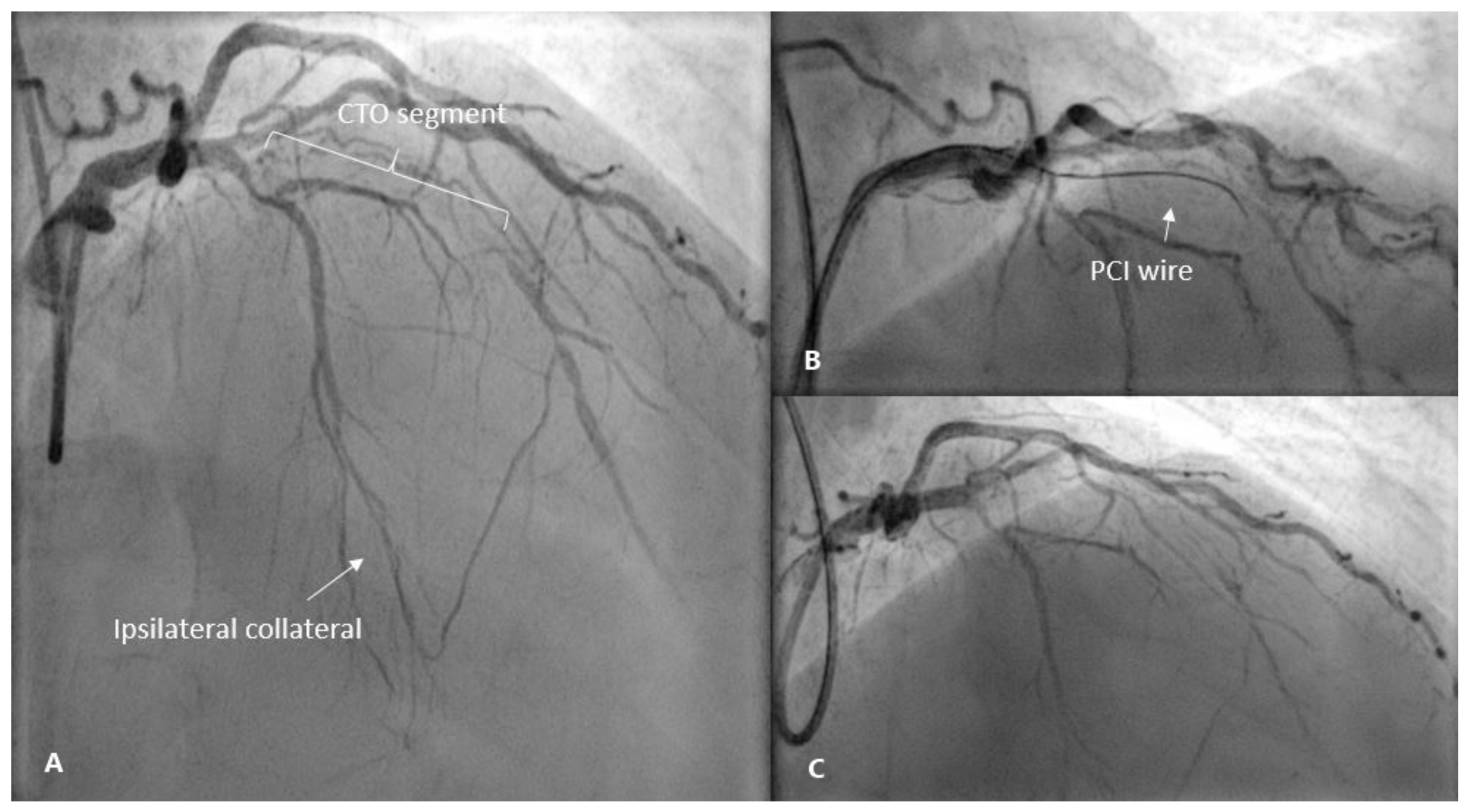 Medicina 57 00490 g002