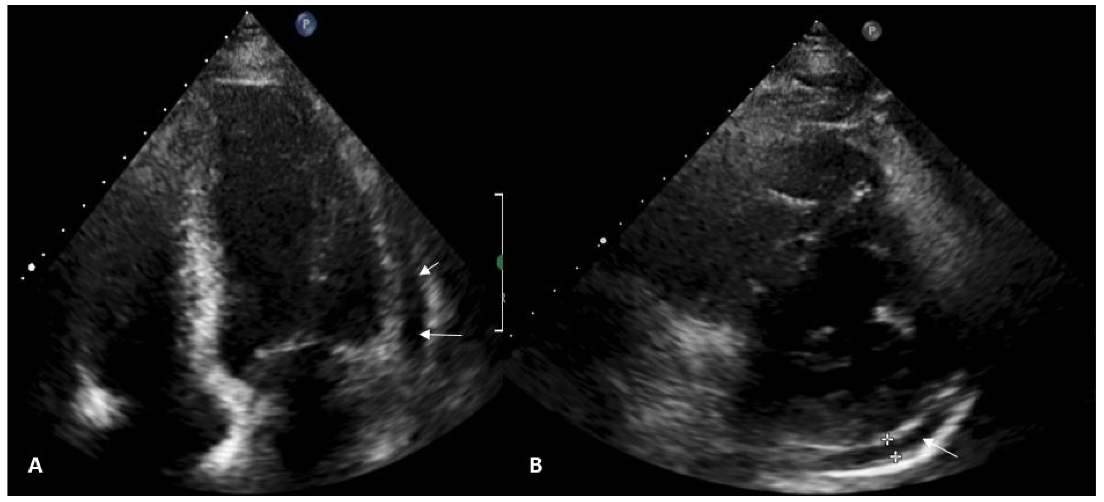Medicina 57 00490 g003