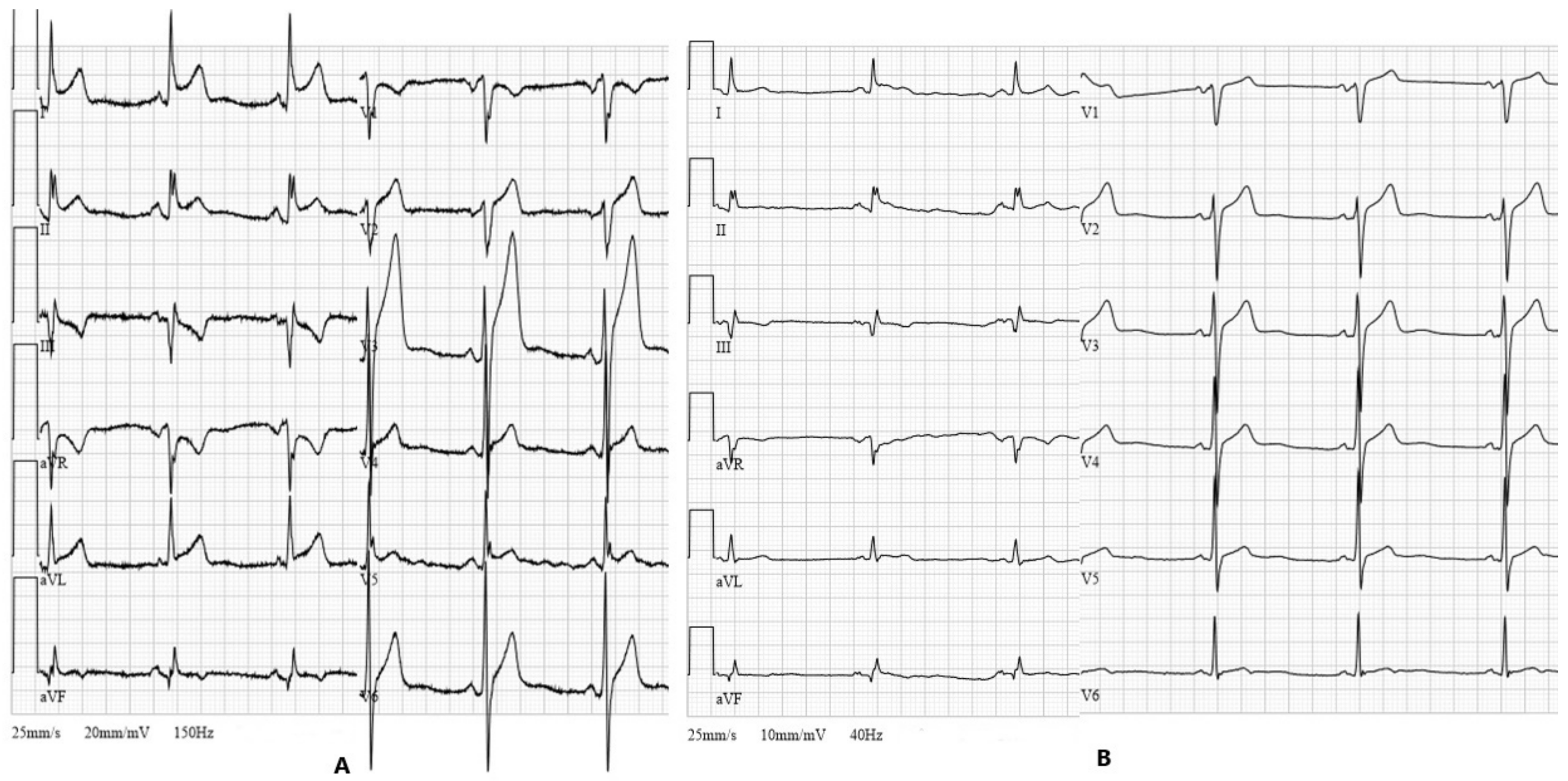 Medicina 57 00490 g004