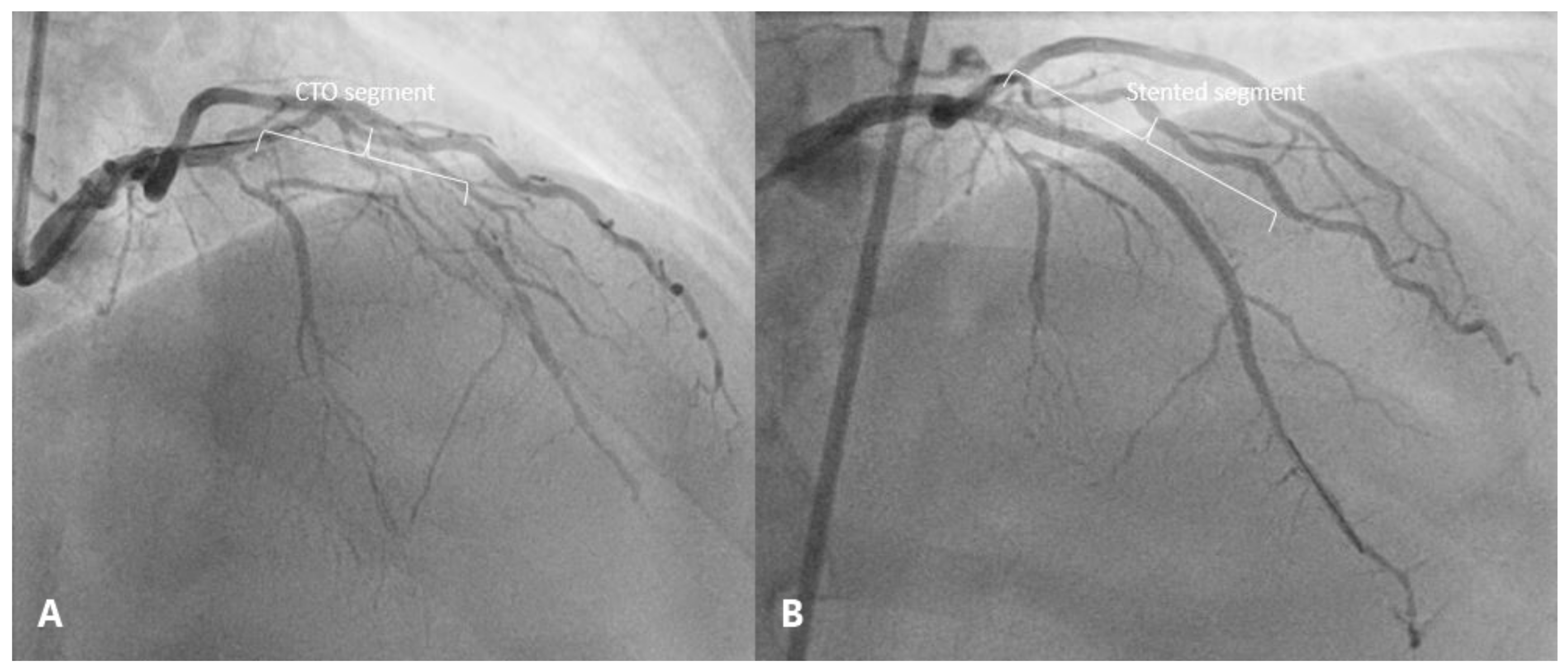 Medicina 57 00490 g005